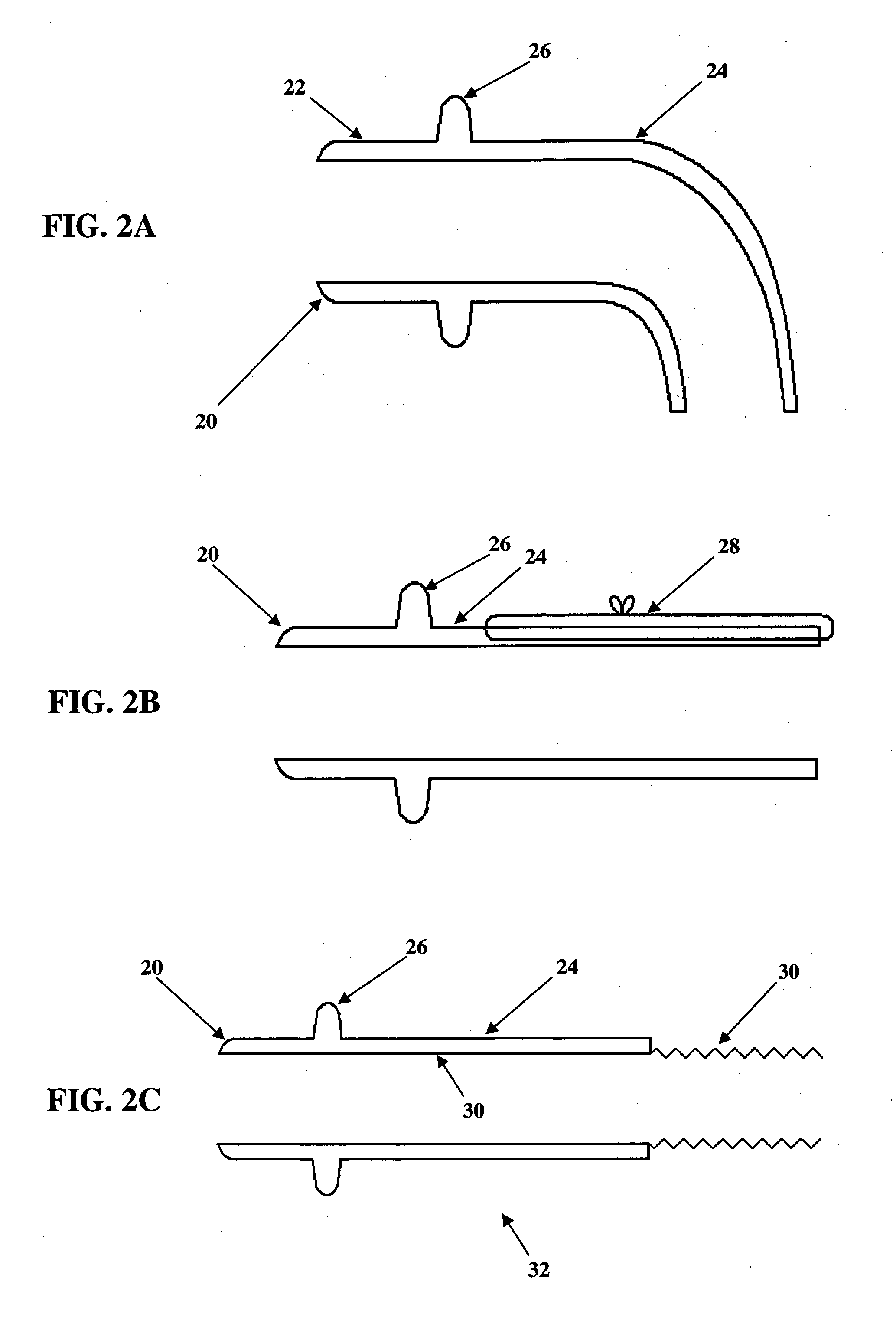 Apparatus and method for connecting a conduit to a hollow organ