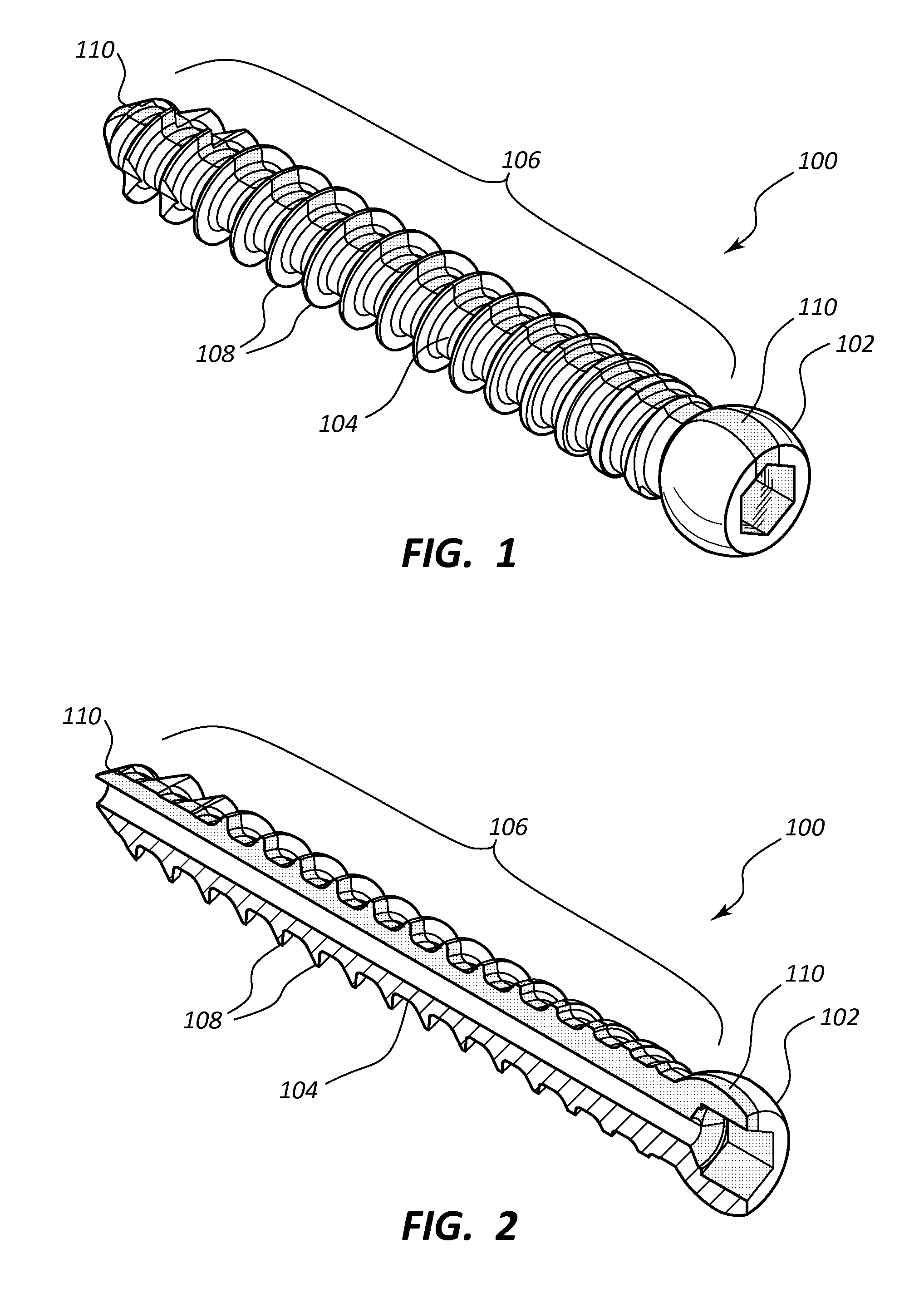Pedicle screw with electro-conductive coating or portion