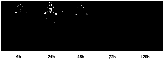 Kit for radionuclide labeled antibody and application thereof