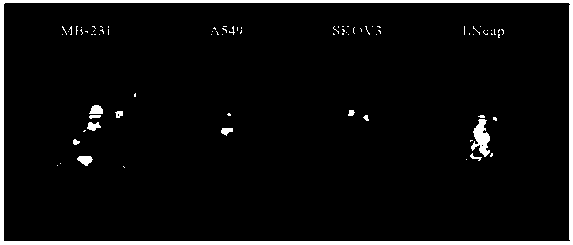 Kit for radionuclide labeled antibody and application thereof