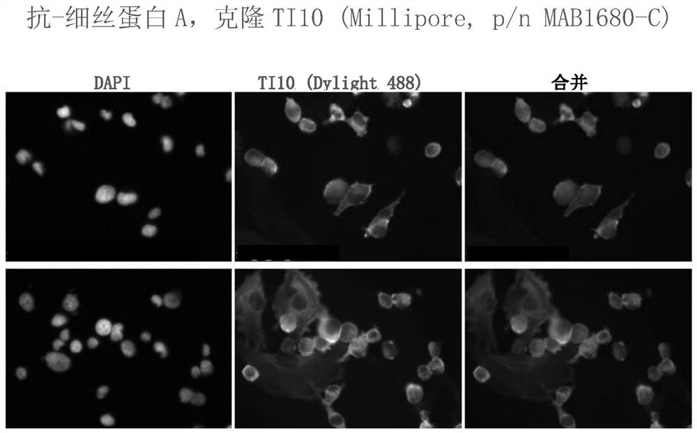 Antibodies directed to filamin-a and therapeutic uses thereof