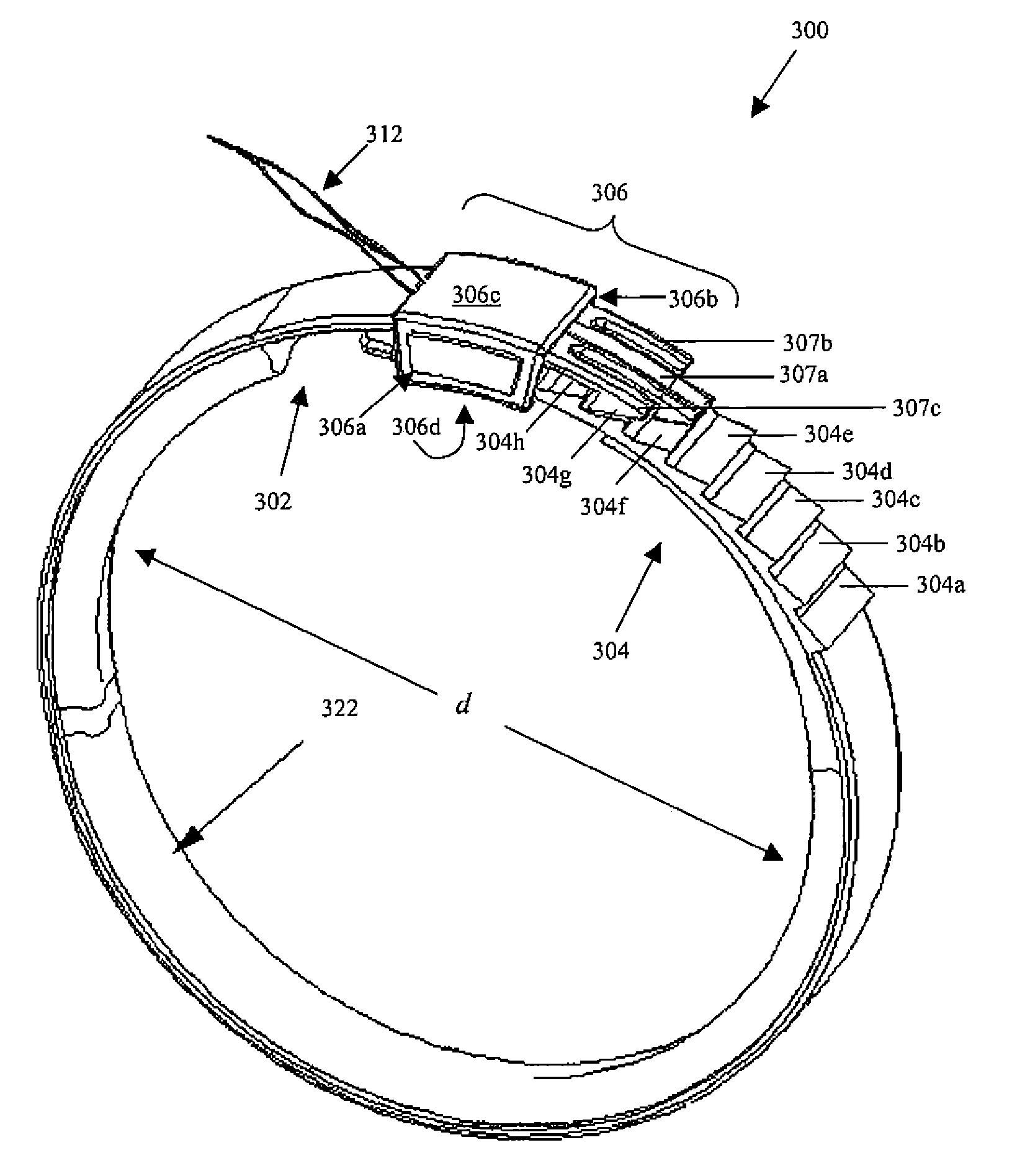 Electroactive polymer actuated gastric band