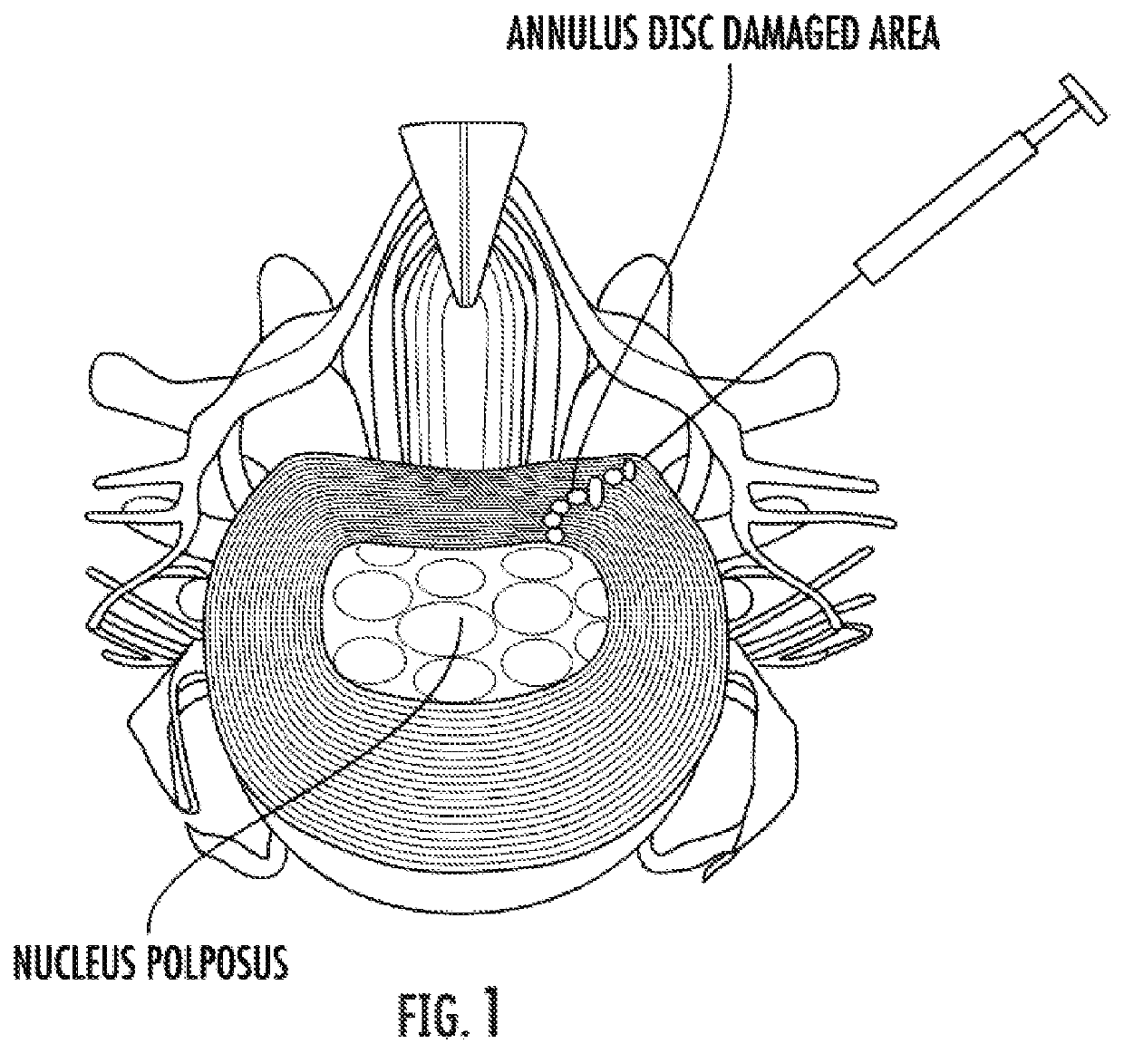 Compositions for treatment of annular spinal disc injury