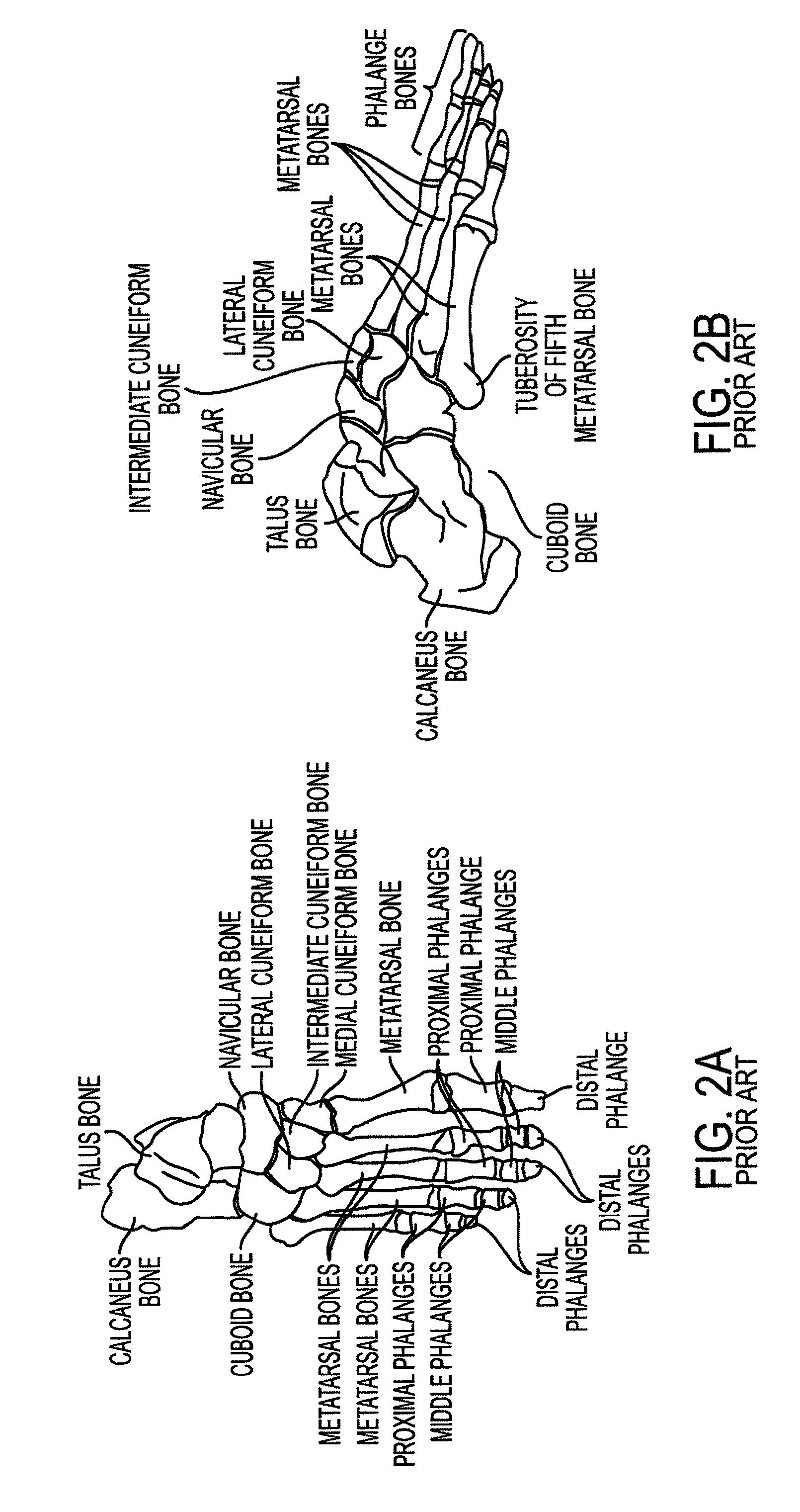 System, method, and computer-program product for measuring pressure points