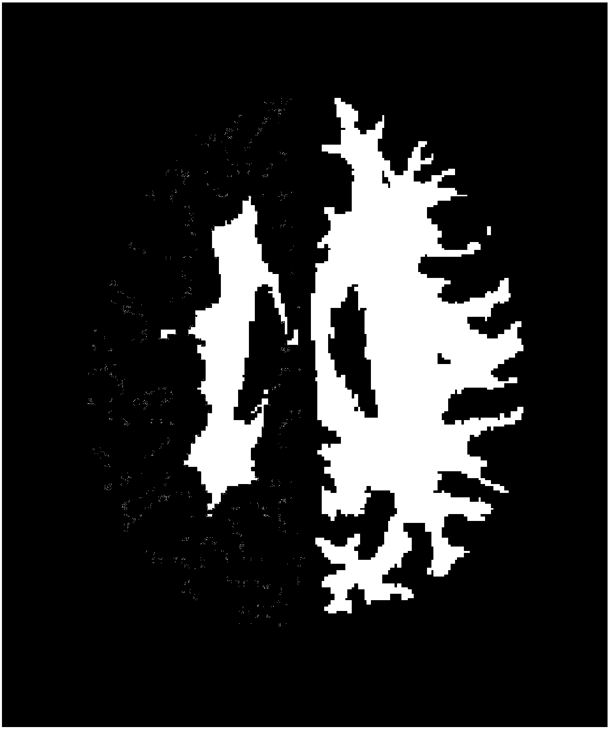 A Method for Describing Local Morphological Features of the Brain Based on Cortical Vertex Clouds