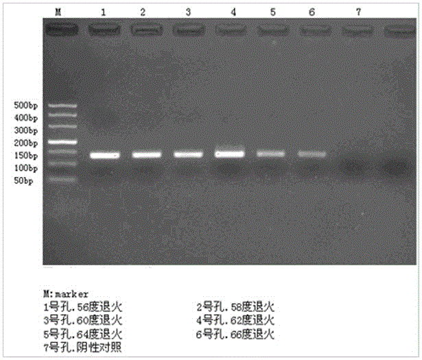 A kind of non-invasive helicobacter pylori gene detection kit and its preparation and detection method