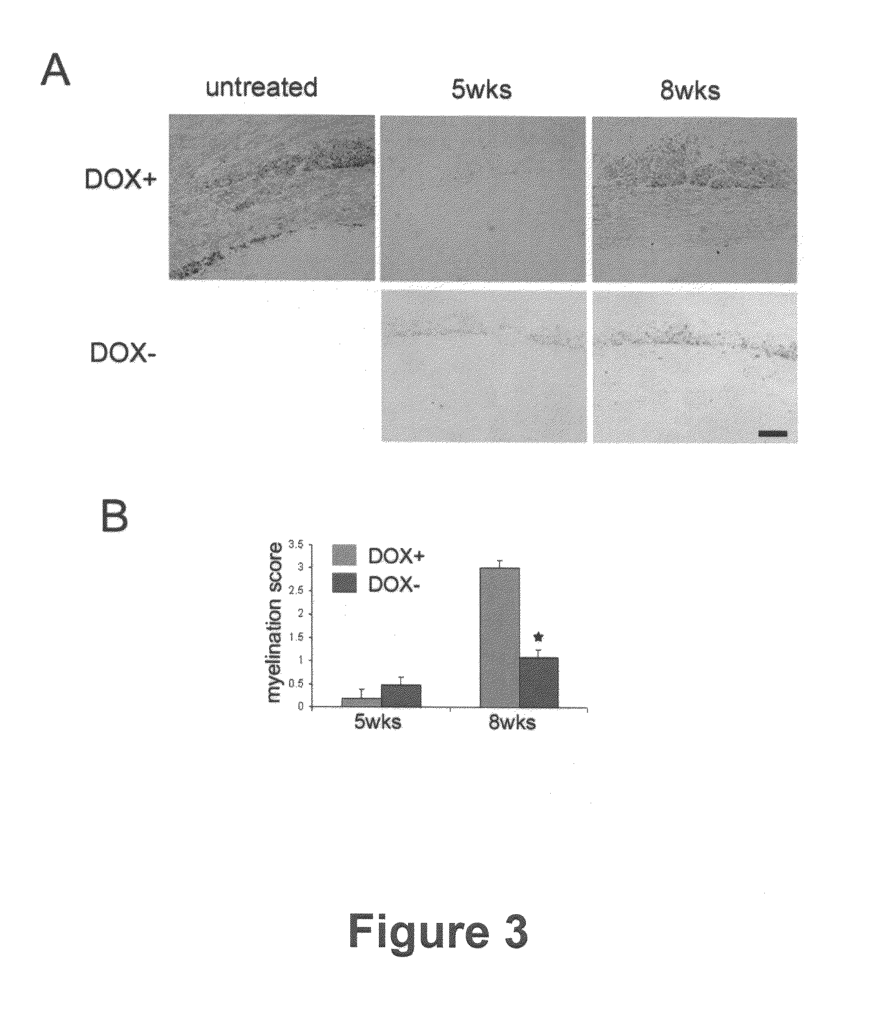 Methods for treating demyelination disorders