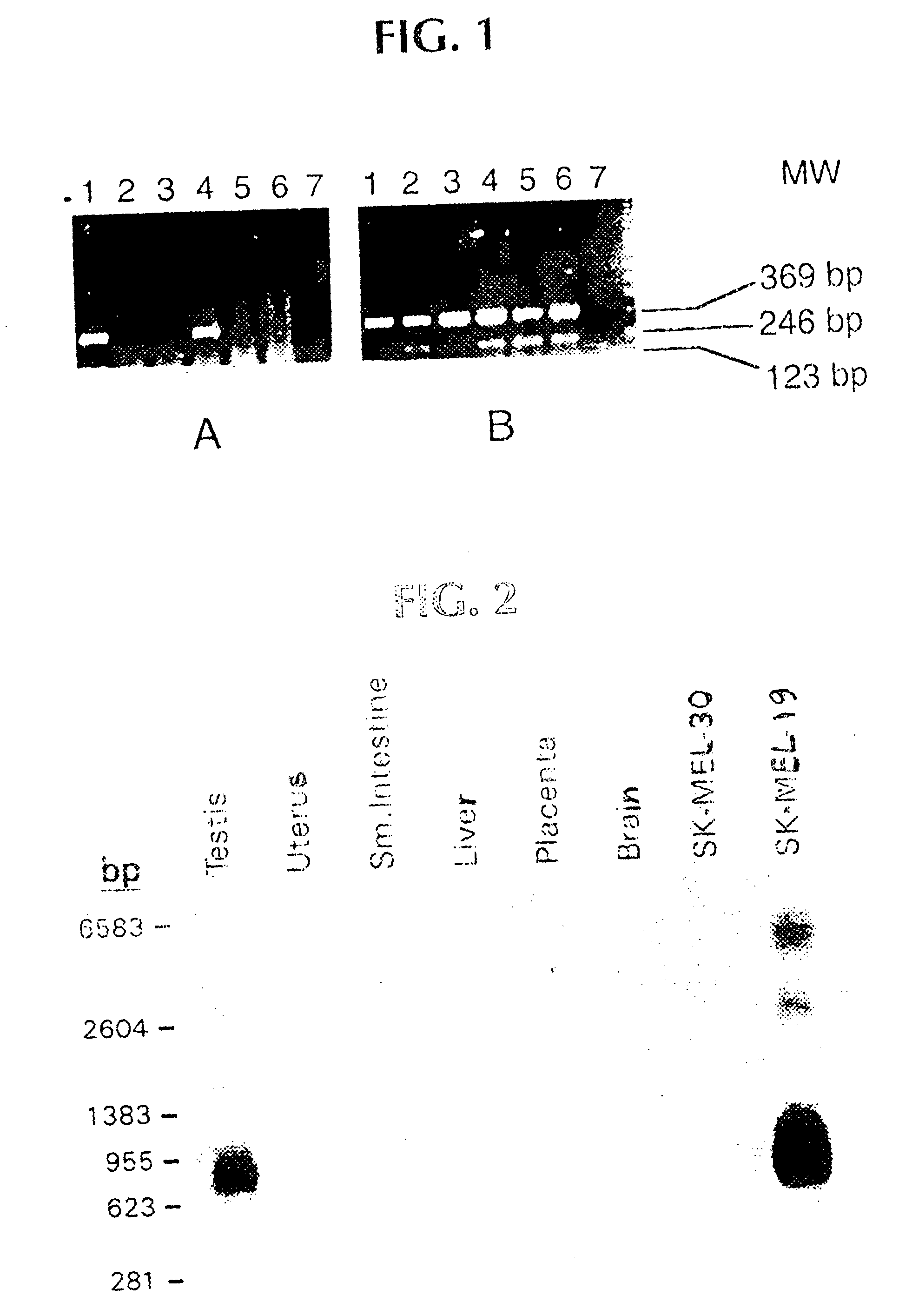 Isolated peptides corresponding to amino acid sequences of NY-ESO-1, which bind to MHC Class I and MHC Class II molecules, and uses thereof