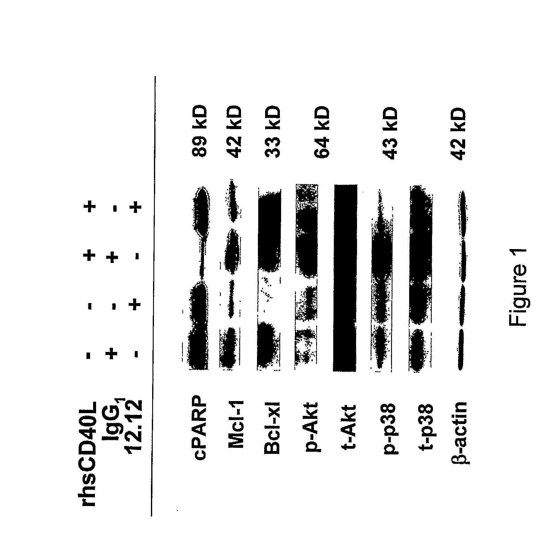 Methods for Diagnosis and Treatment of Diseases Having an Autoimmune and/or Inflammatory Component
