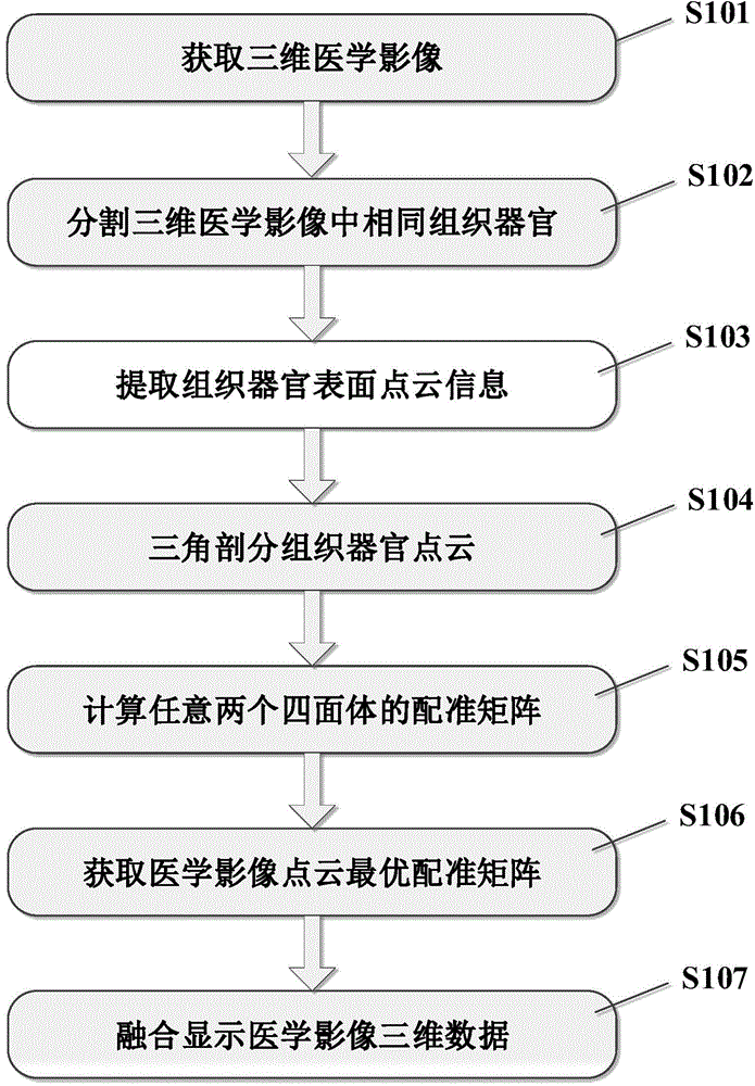 Triangulation optical matching based medical image rigid registration method