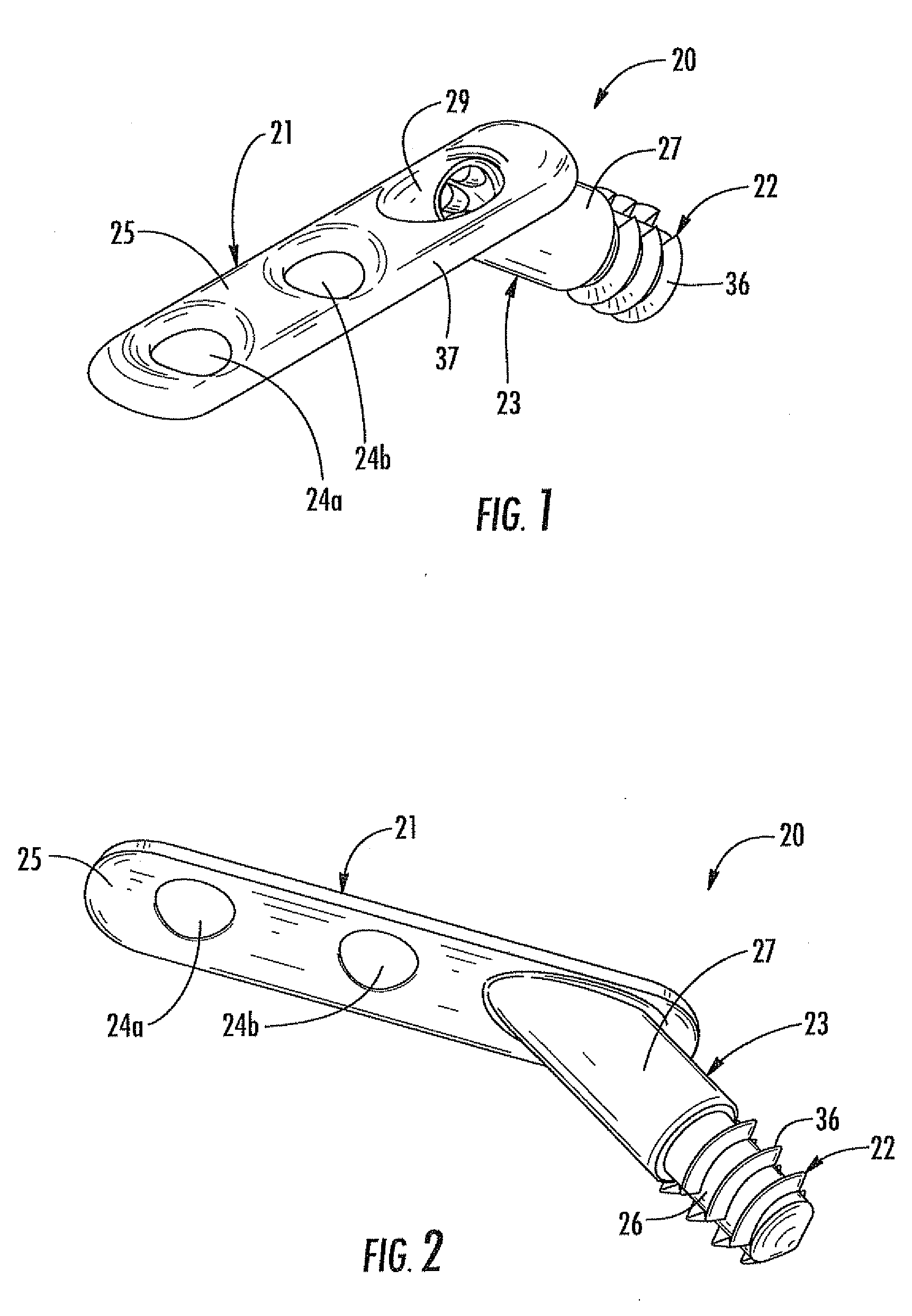 Arthrodesis implant for finger joints and related methods