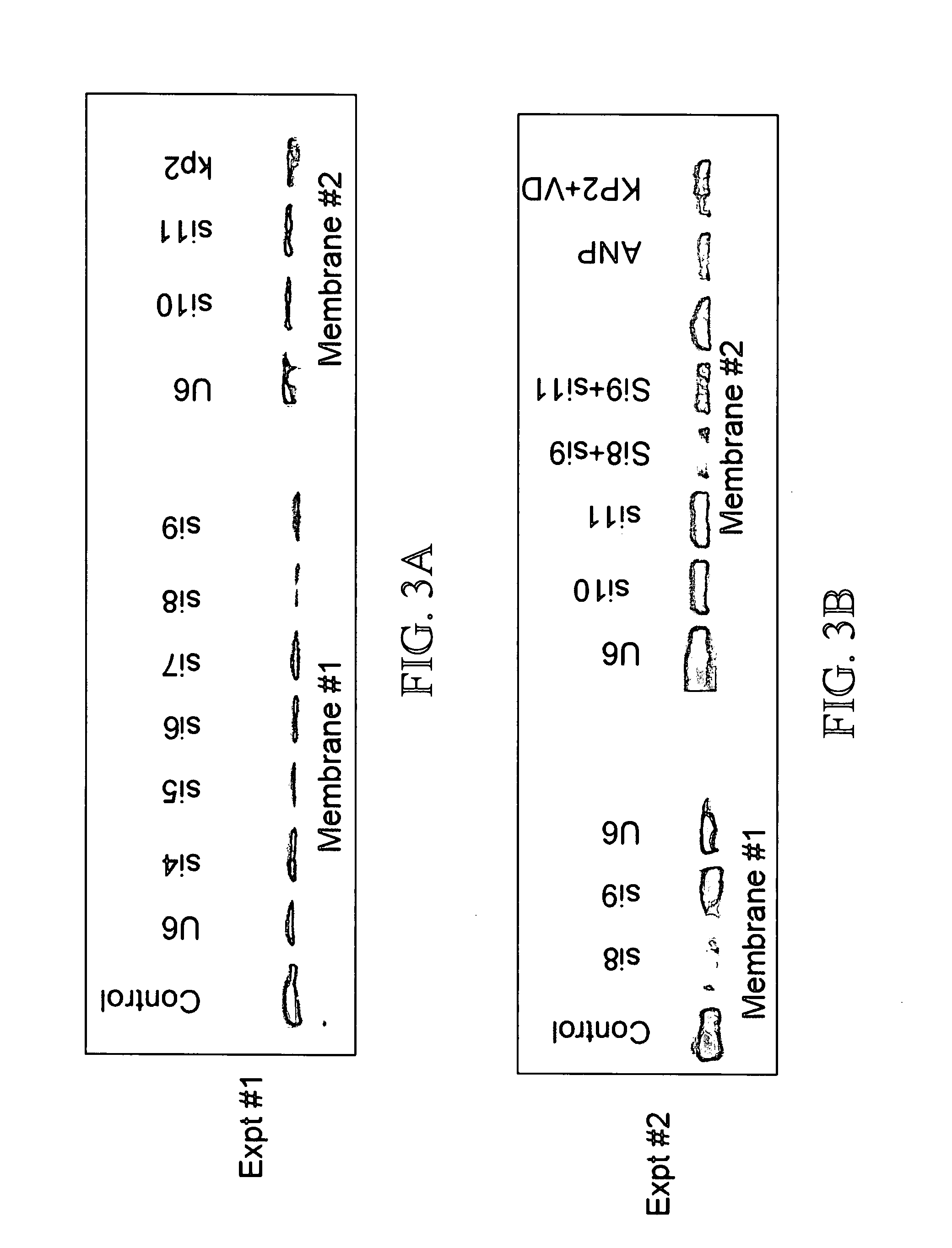 Materials and methods for reducing inflammation by inhibition of the atrial natriuretic peptide receptor