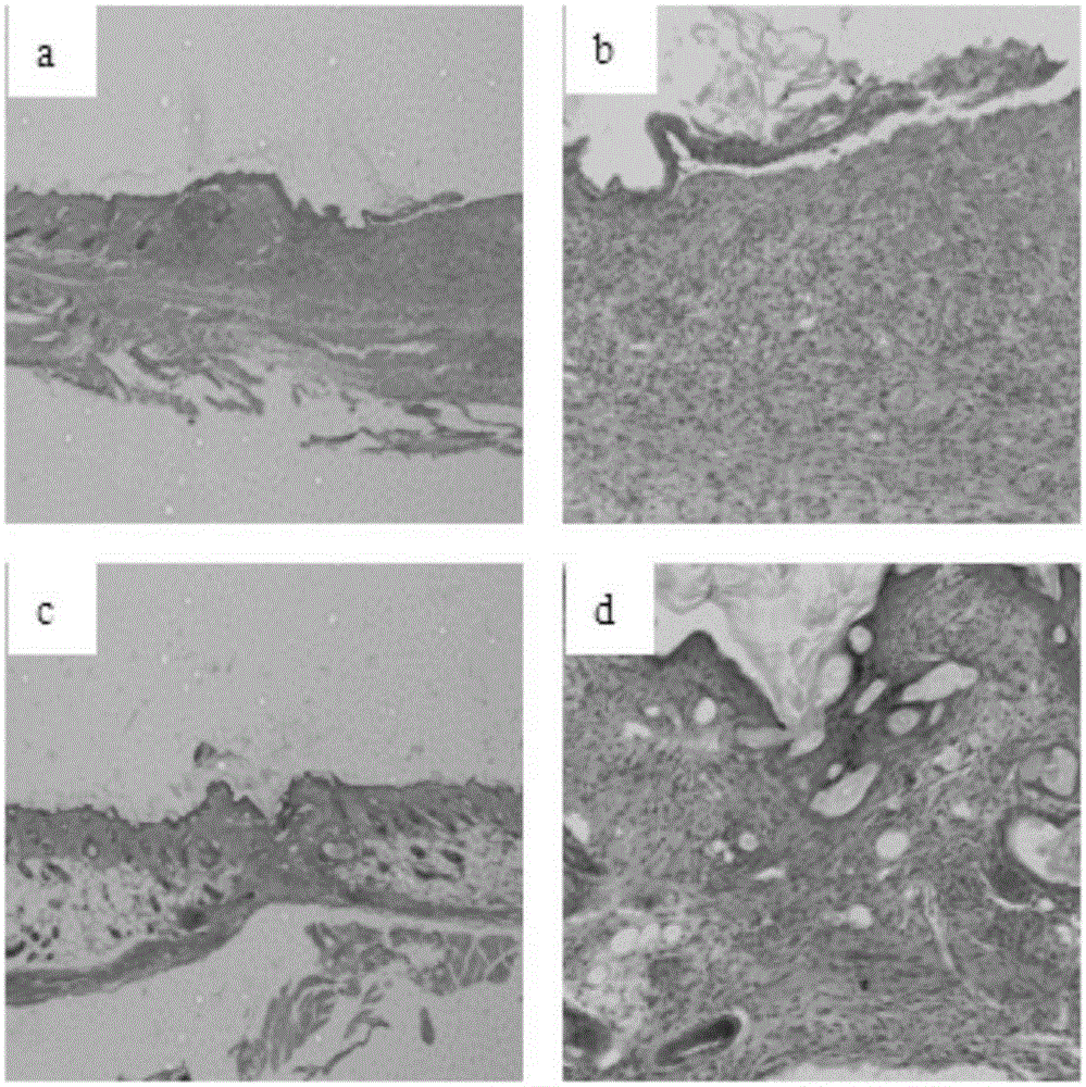 A kind of porous silicone rubber/polyurethane double-layer artificial skin containing nano-silver and its preparation method