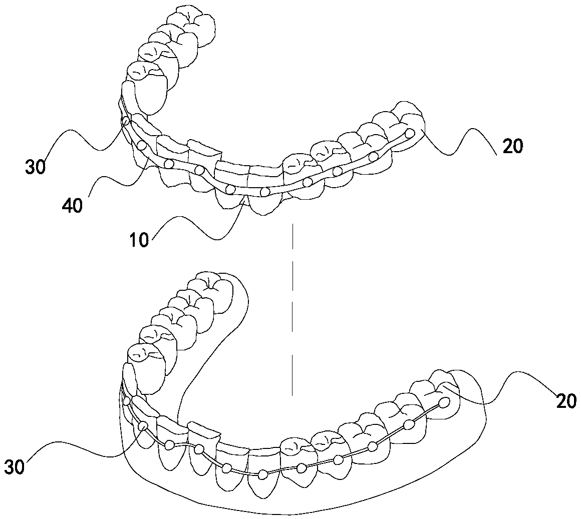 Accessory for invisible dental orthodontics and set for dental orthodontics