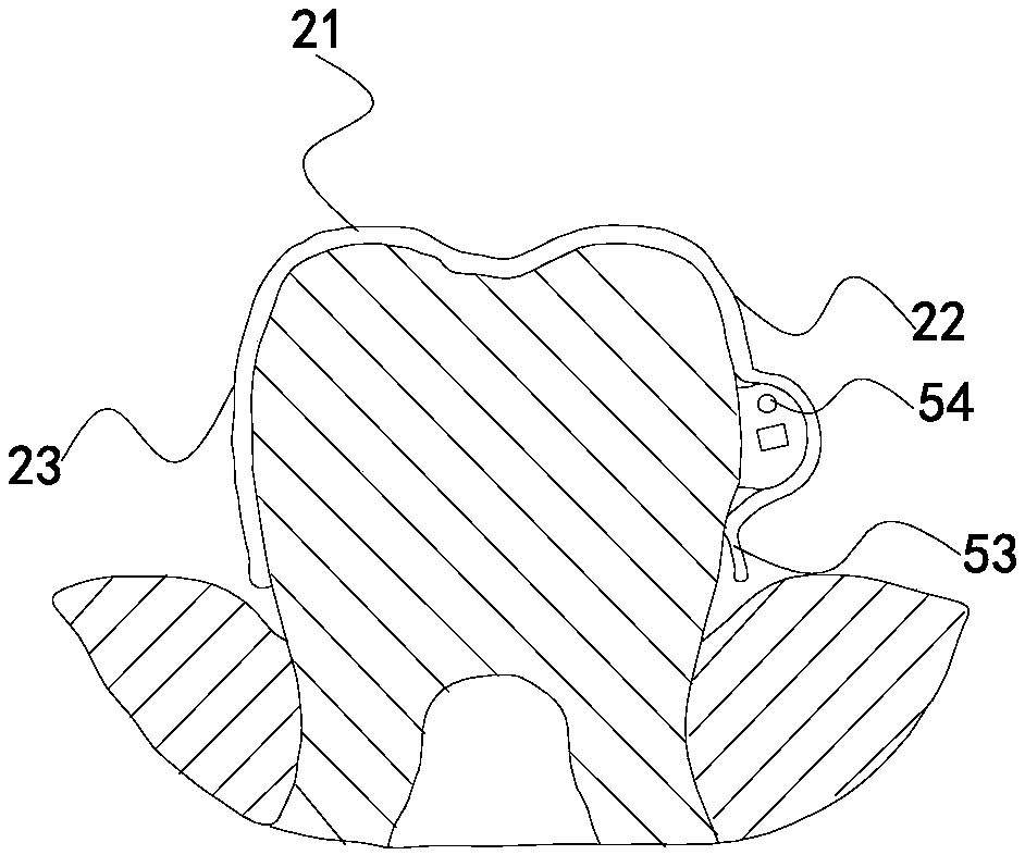 Accessory for invisible dental orthodontics and set for dental orthodontics