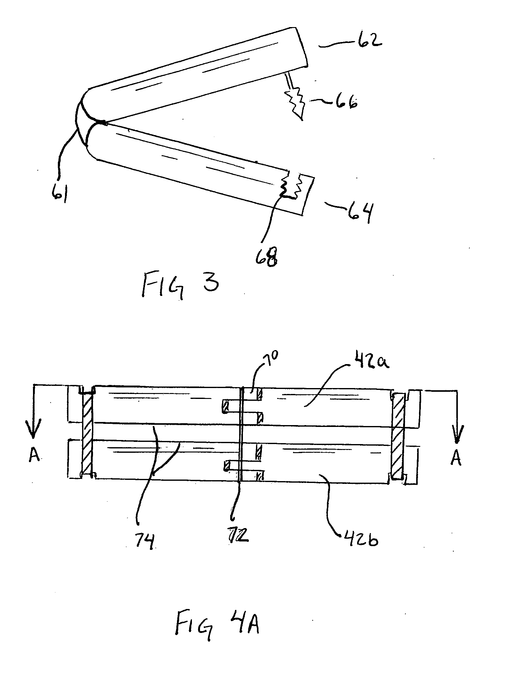 Method and apparatus for partioning an organ within the body