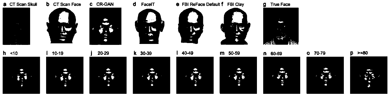 A craniofacial restoration method based on a deep generative adversarial network