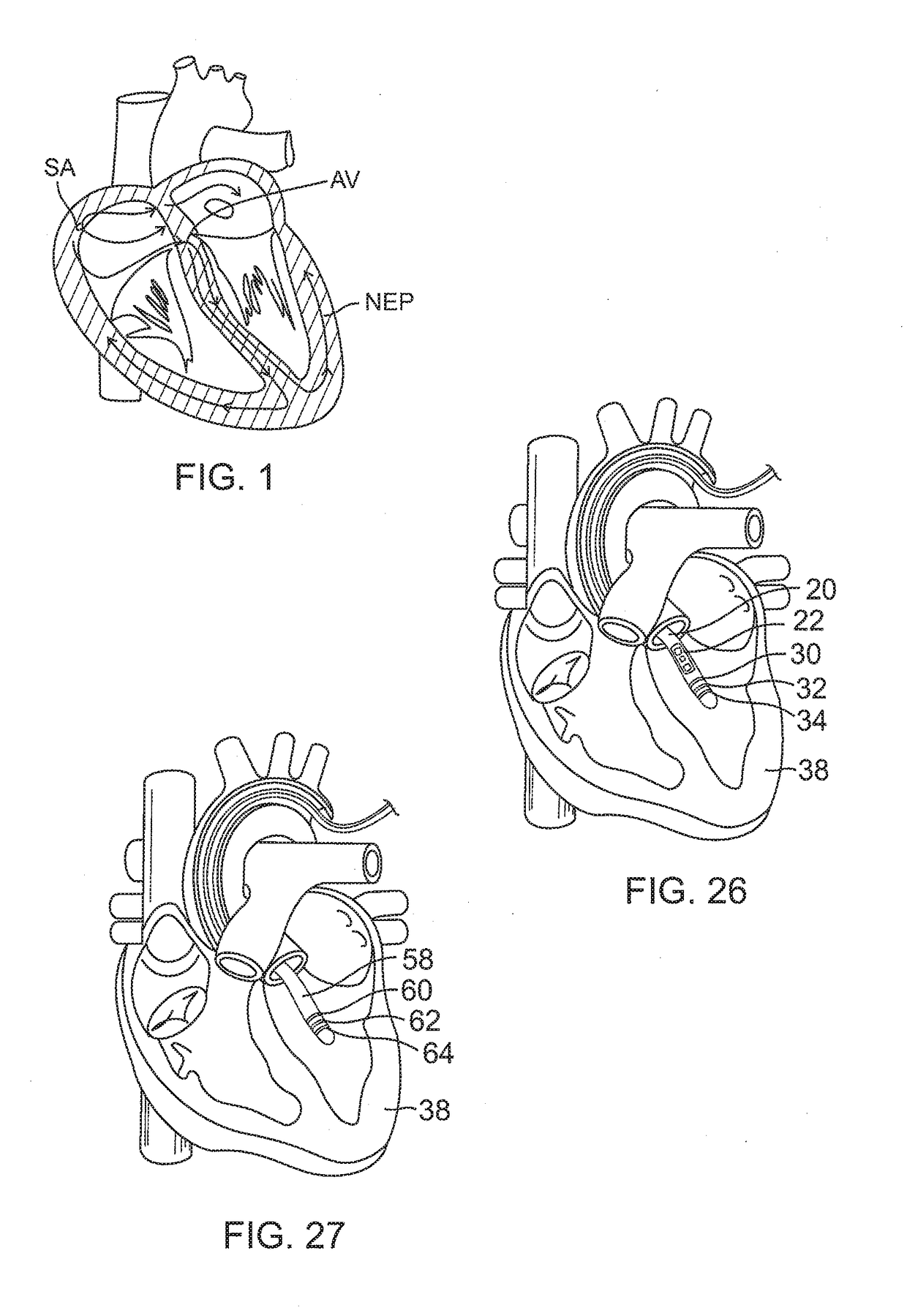 System and method for visualizing electrophysiology data