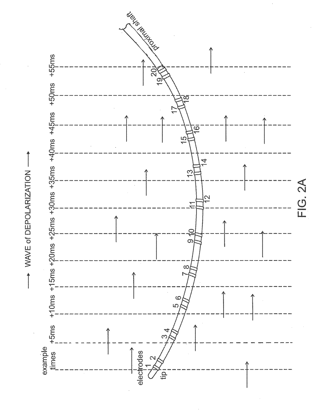 System and method for visualizing electrophysiology data