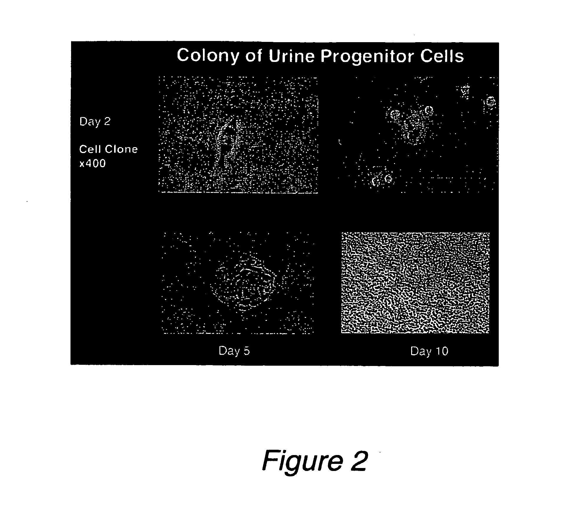 Progenitor cells from urine and methods for using the same