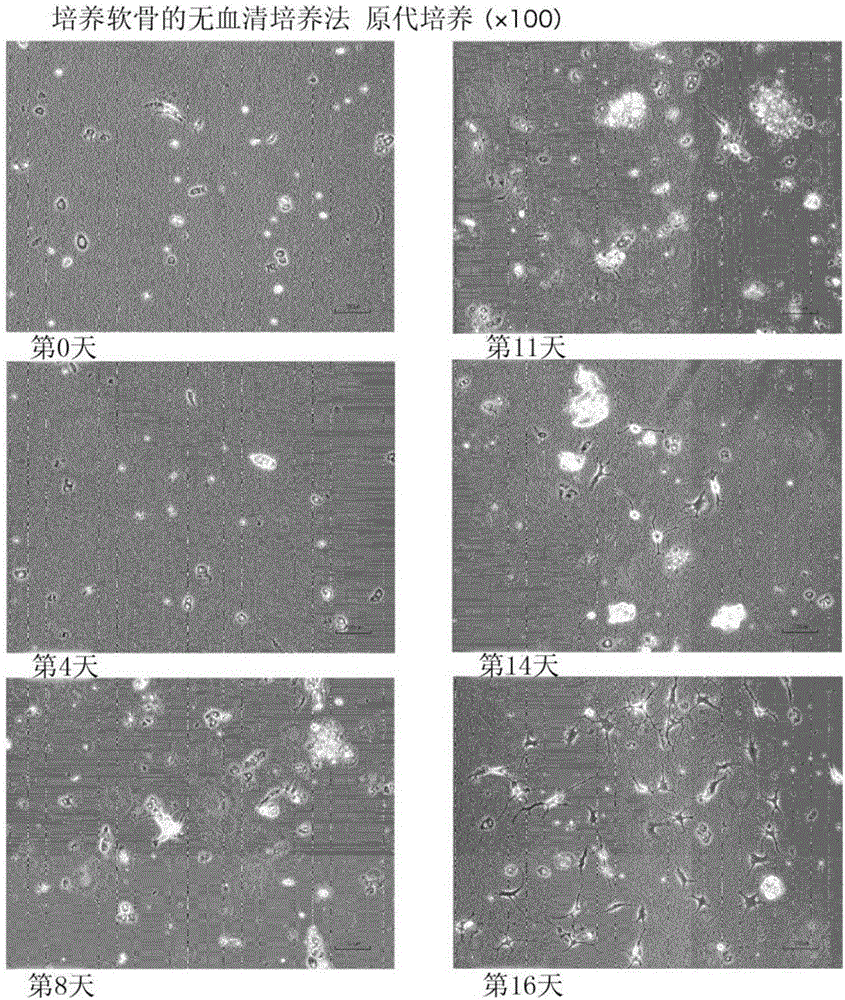 Method for serum-free culture of cartilage cells and serum-free culture medium