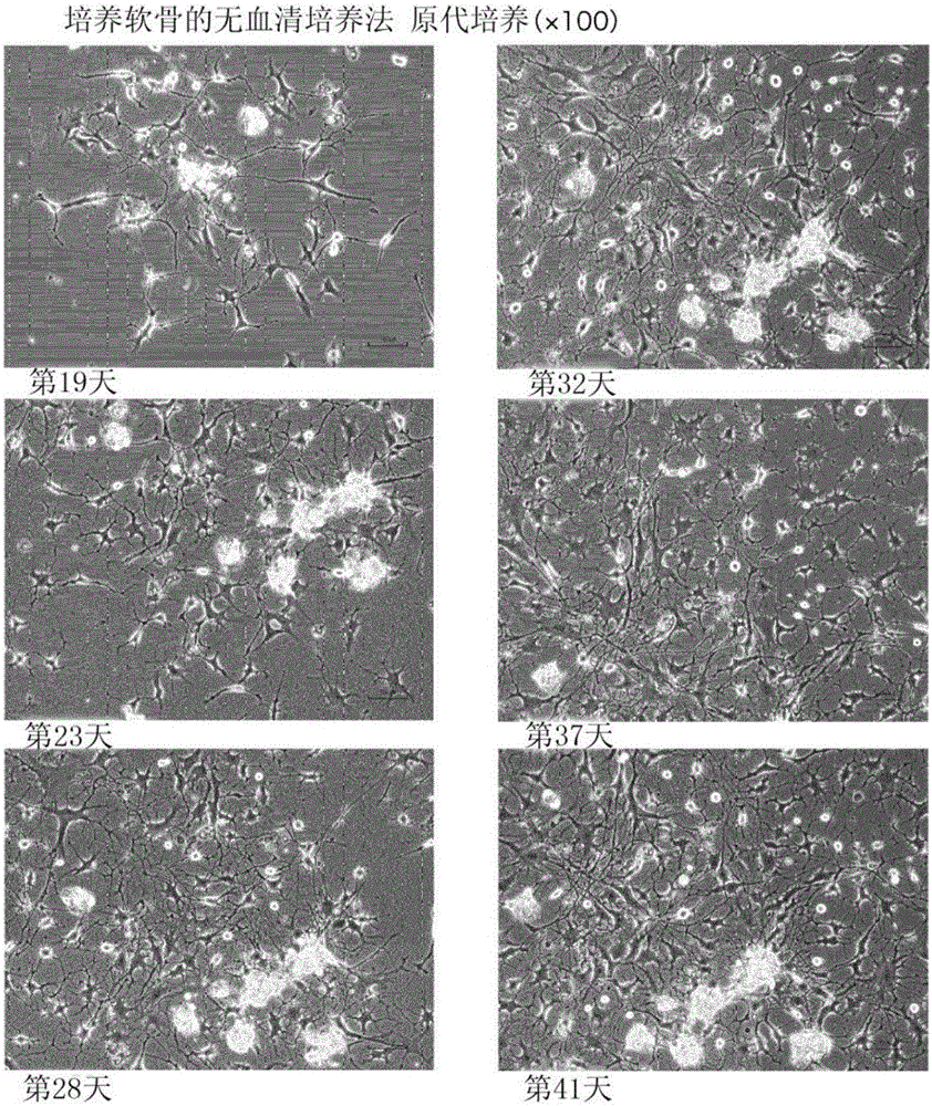 Method for serum-free culture of cartilage cells and serum-free culture medium