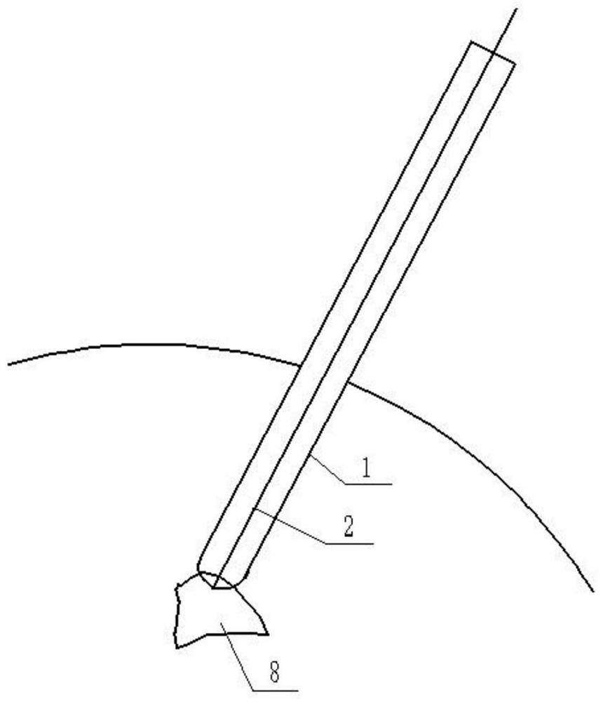 Cerebral hemorrhage hematoma channel establishing device