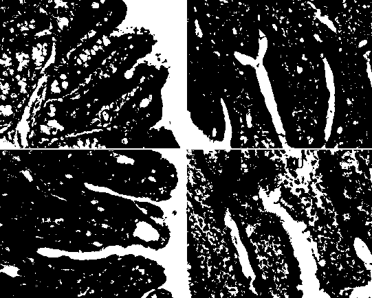 Enteral nutrition preparation capable of protecting intestinal mucosal barrier function injured by chemotherapy