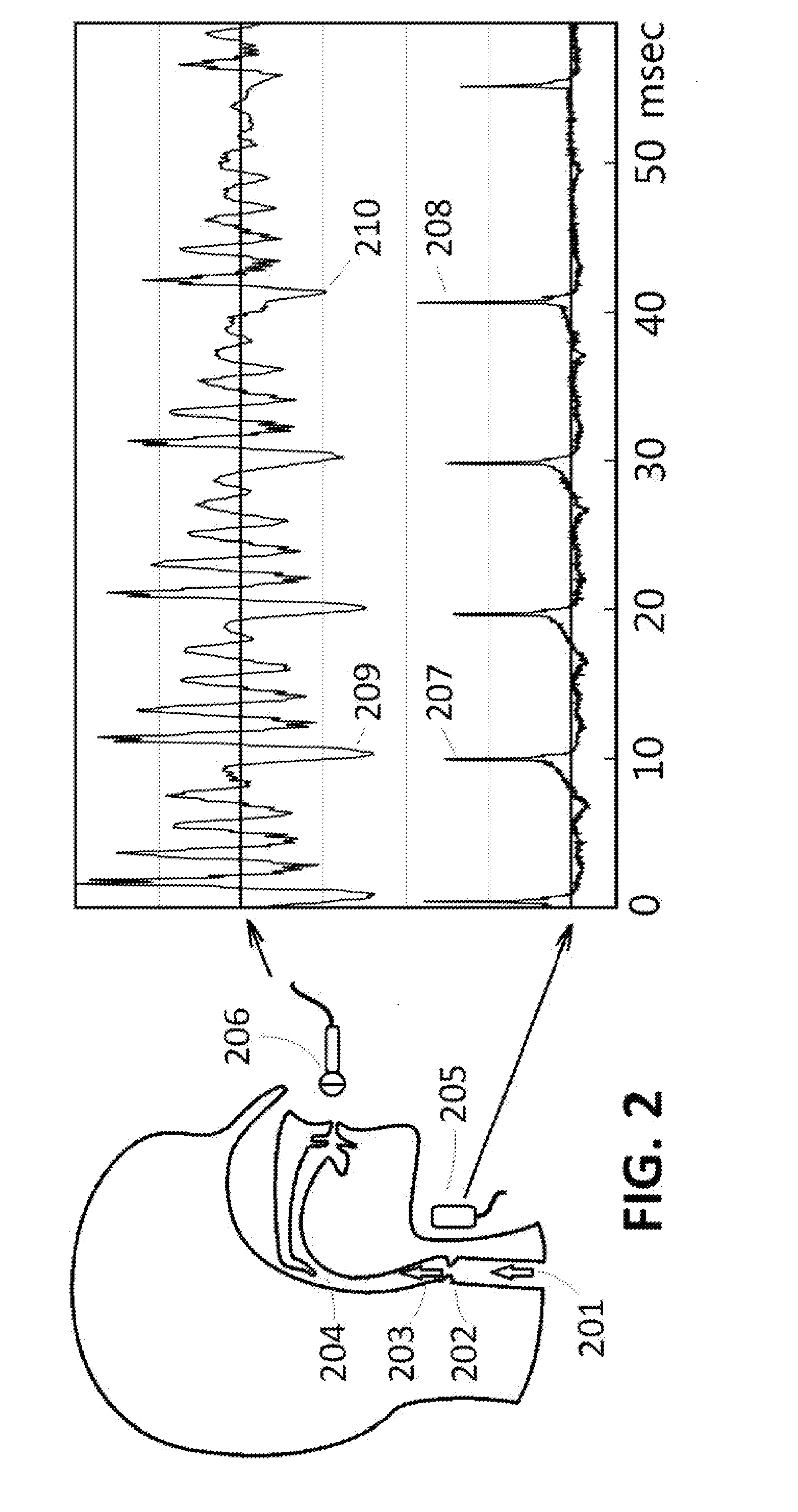 System and method for voice transformation