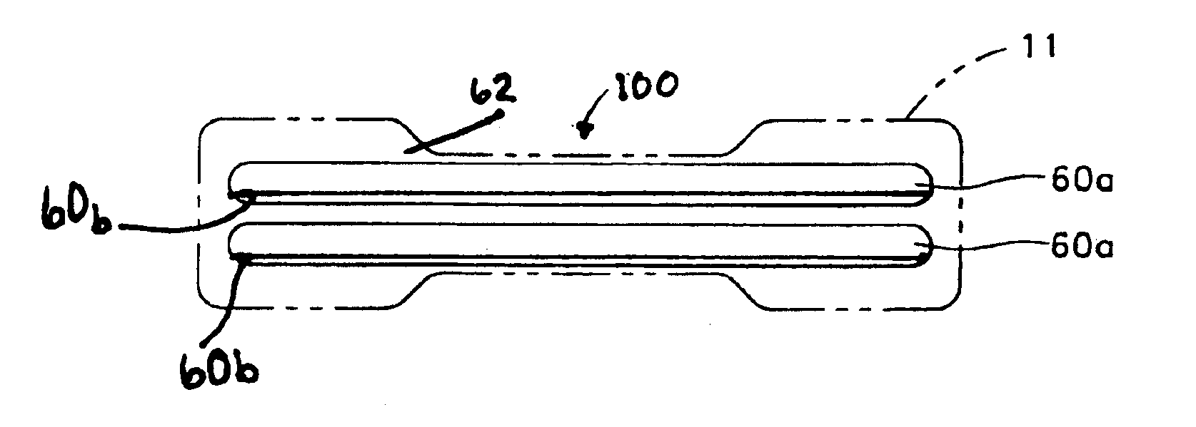 Method and structure for nasal dilator