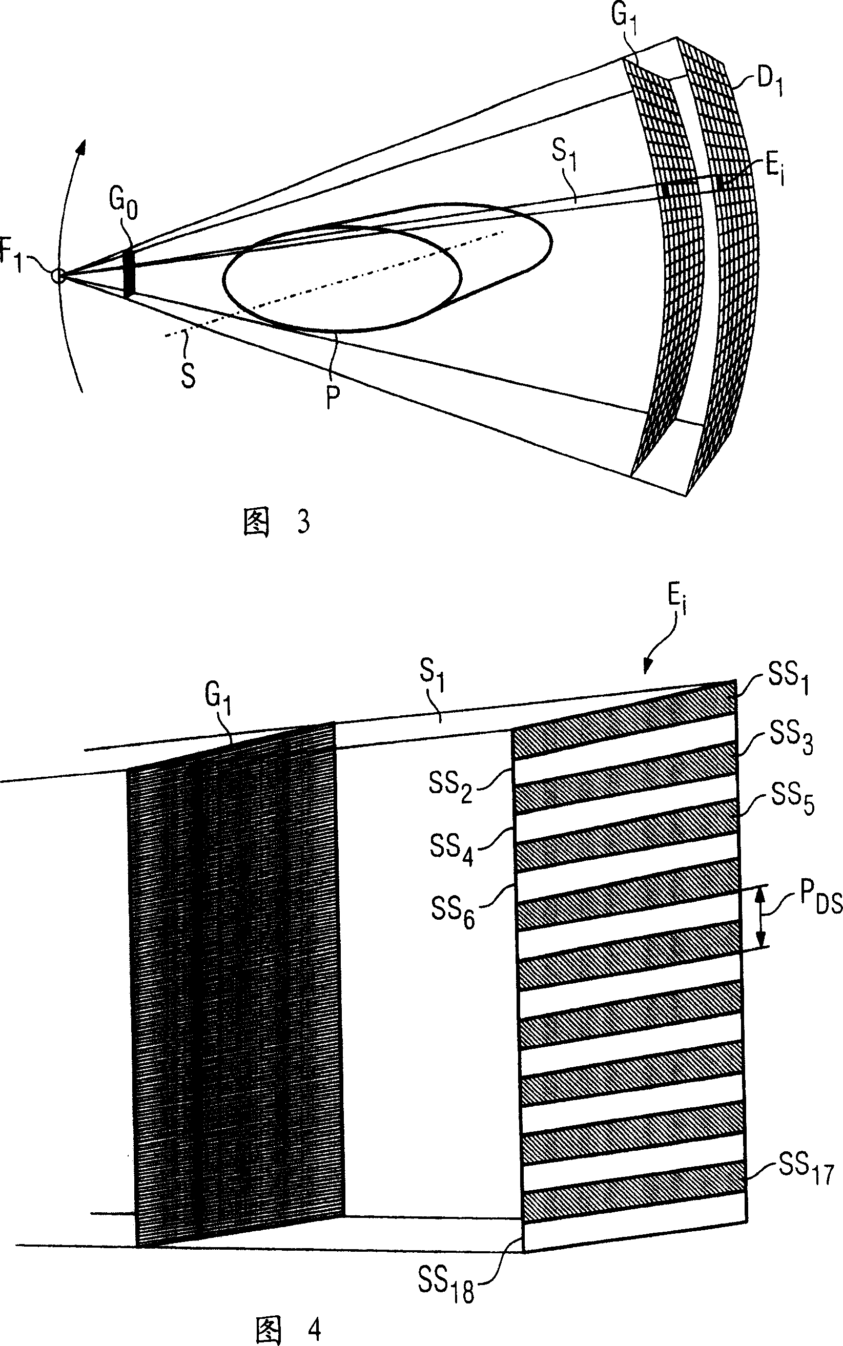 Method and CT system for detecting and differentiating plaque in vessel structures of a patient