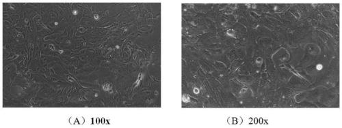 Establishment and application method of immortalized Hu sheep rumen epithelial cell line