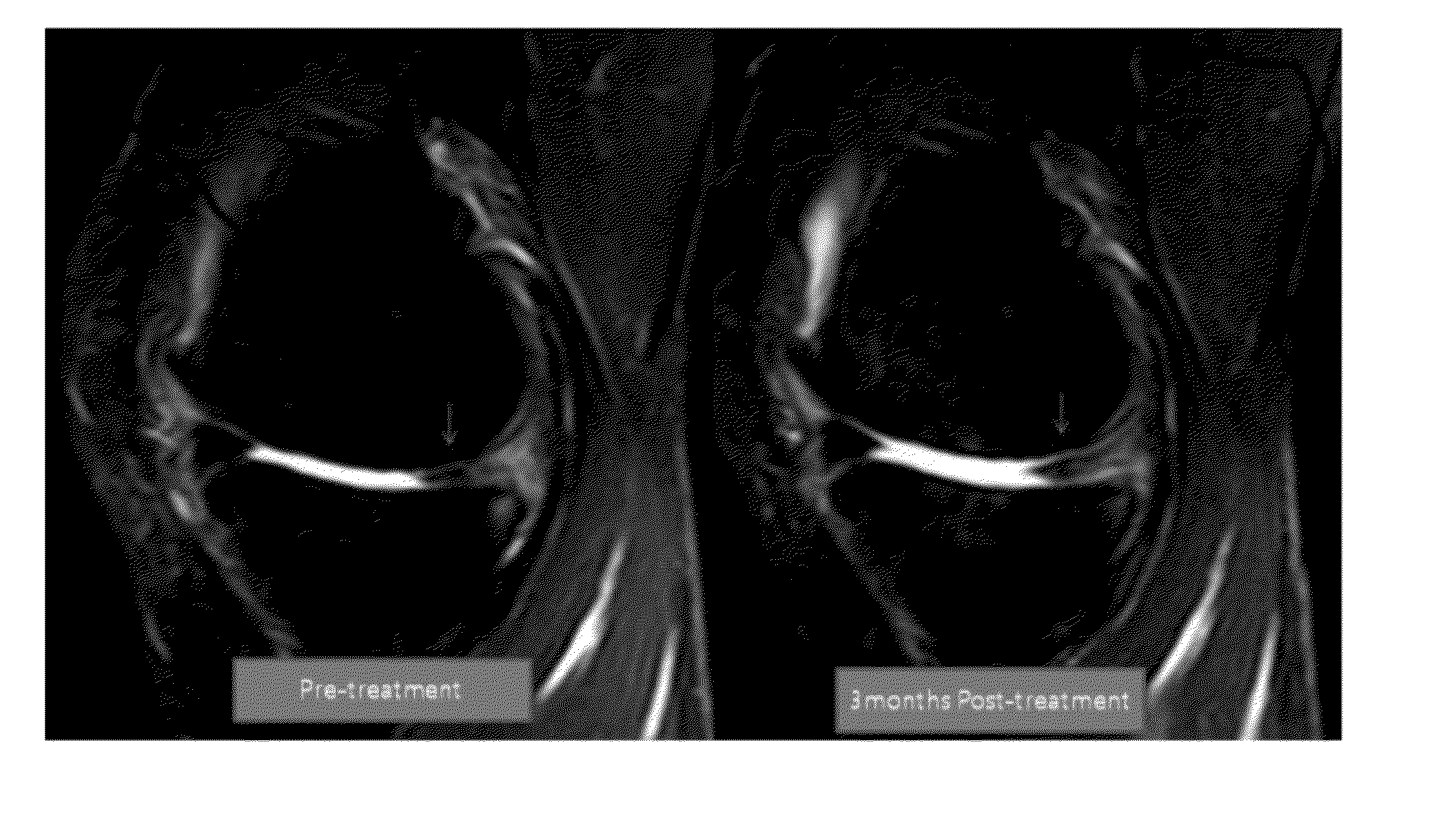 Apparatus, system, and method for compositions and methods for treating, preventing, or alleviating bone or cartilage diseases