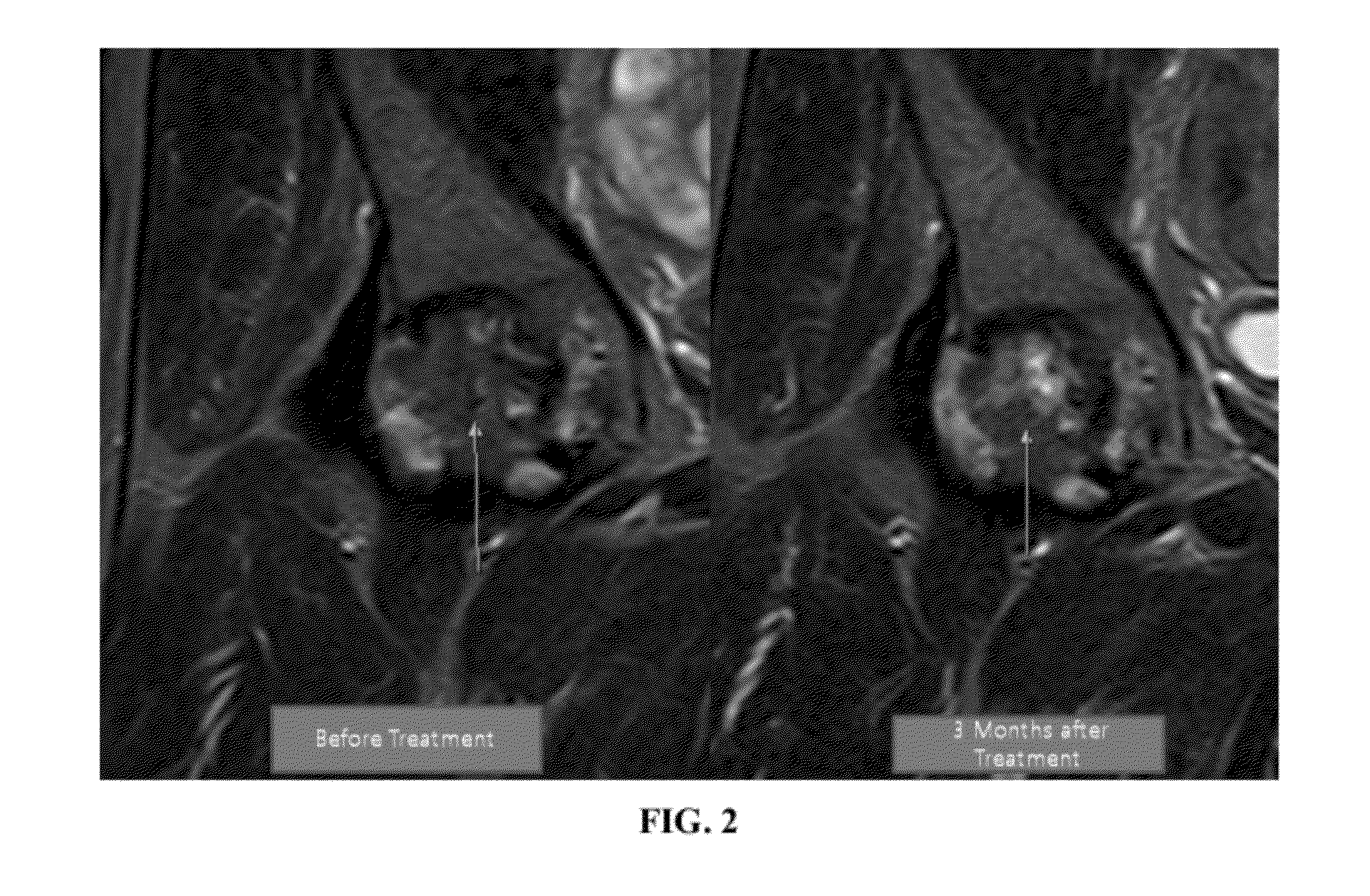 Apparatus, system, and method for compositions and methods for treating, preventing, or alleviating bone or cartilage diseases