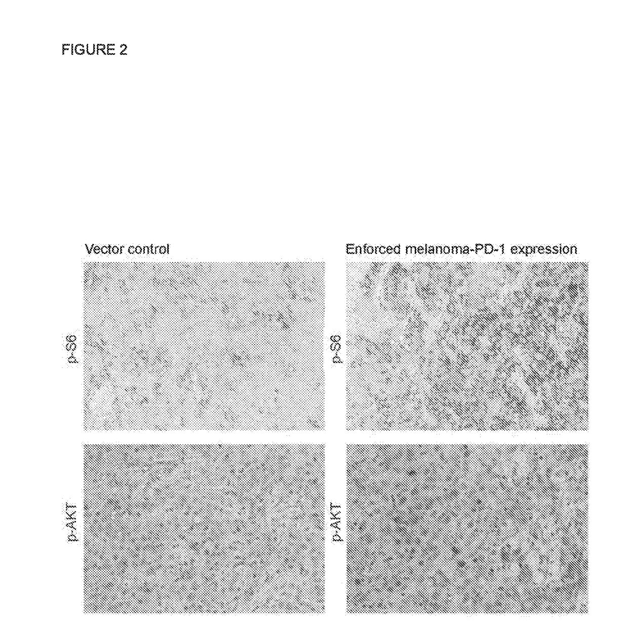 Programmed cell death (pd-1) inhibitor therapy for patients with pd-1-expressing cancers