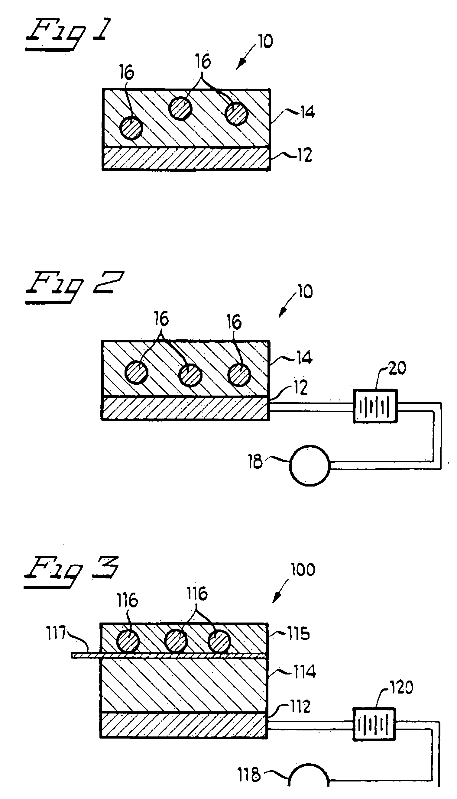 Methods for treating neoplastic, angiogenic, fibroblastic, and/or immunosuppressive ocular irregularities via administration of methotrexate based medicaments, and ocular iontophoretic devices for delivering methotrexate based medicaments