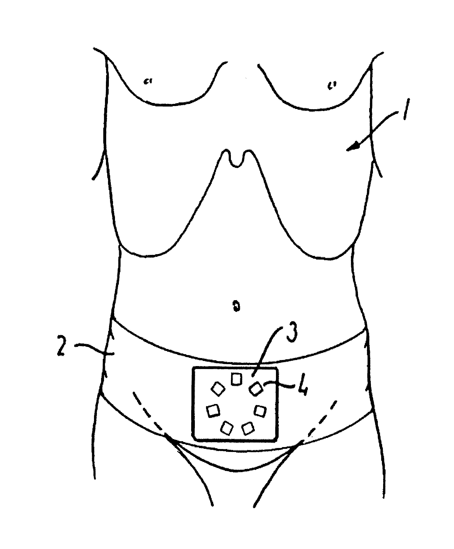 Method and an apparatus for recording bladder volume