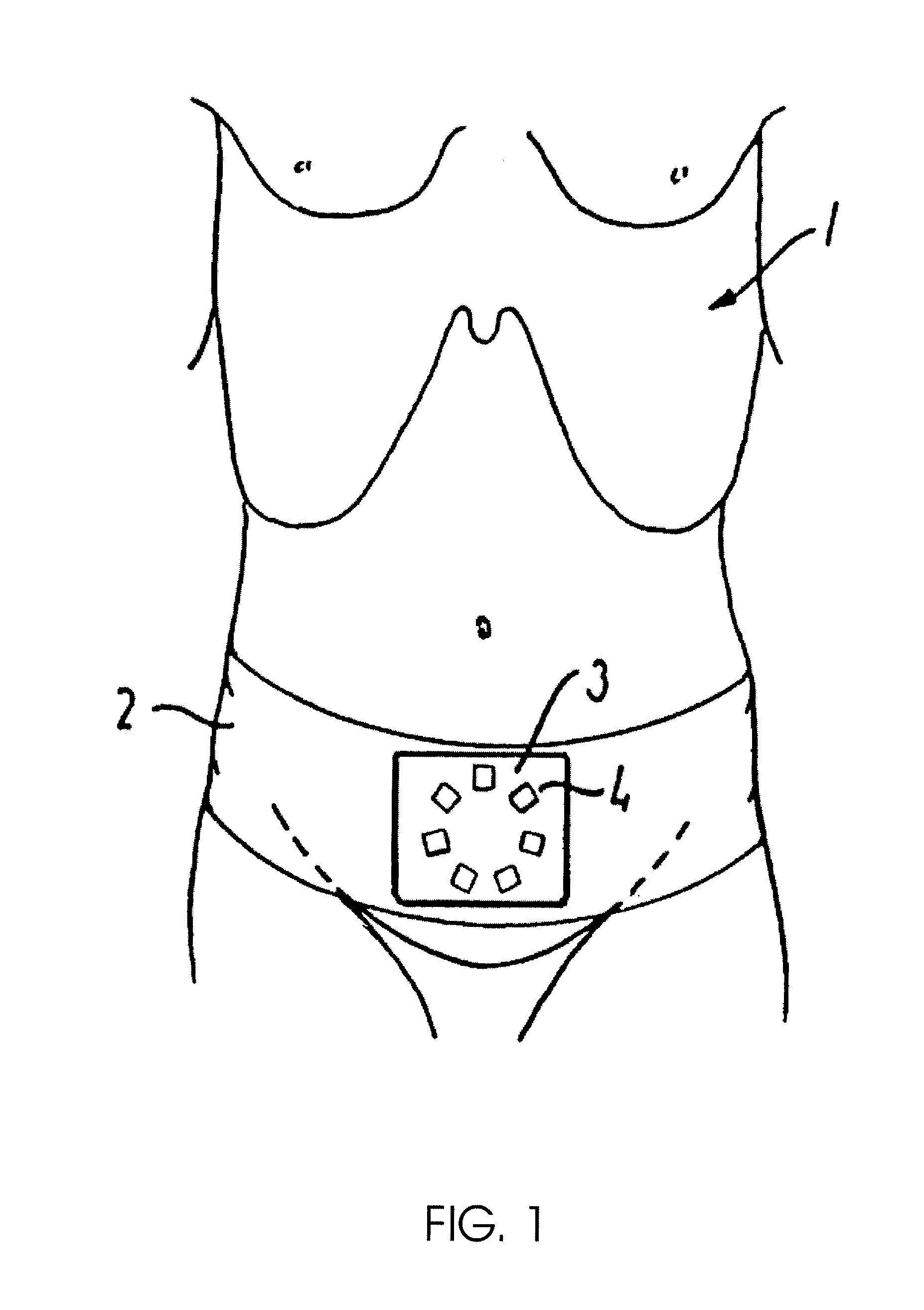 Method and an apparatus for recording bladder volume