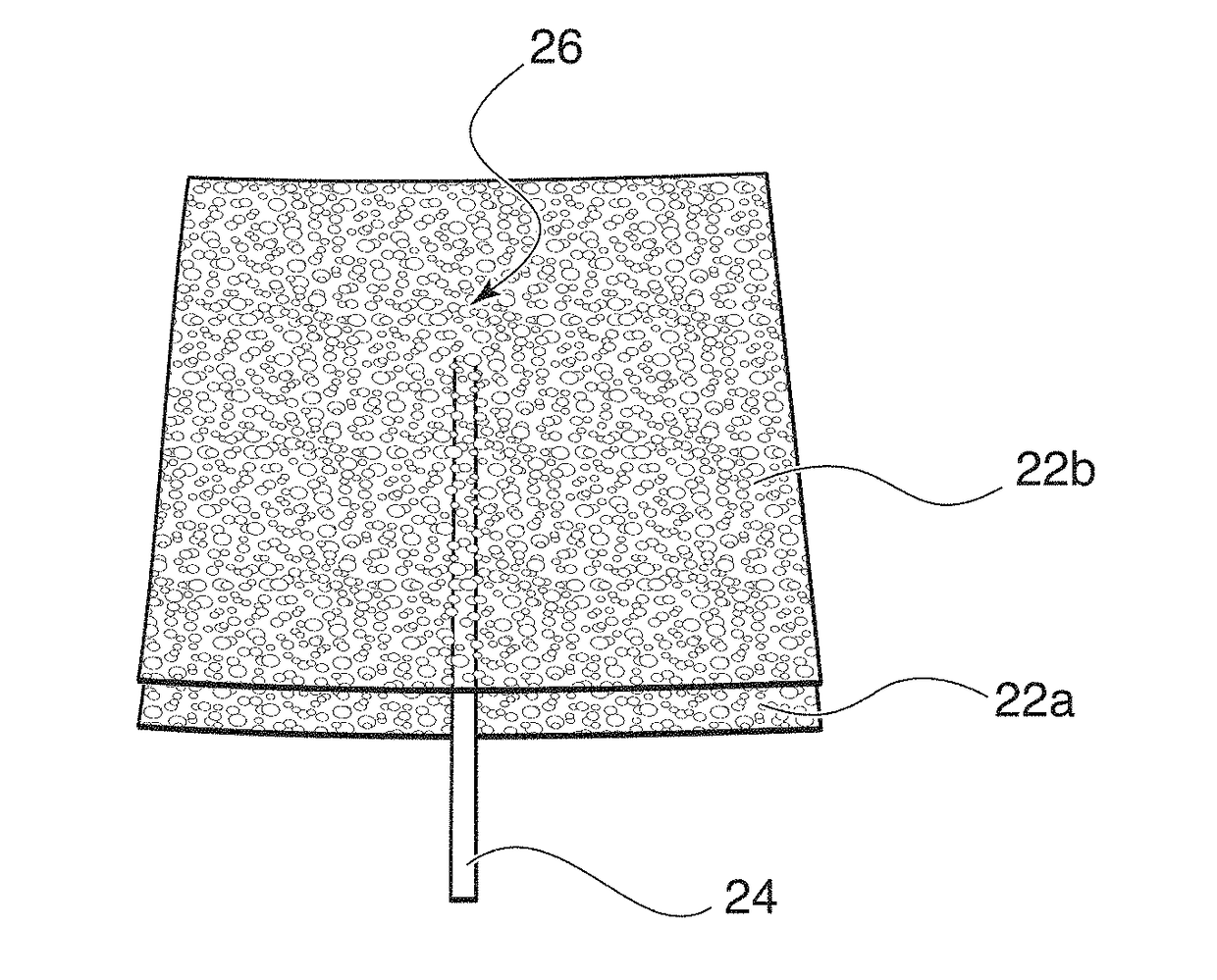 Channel Implant