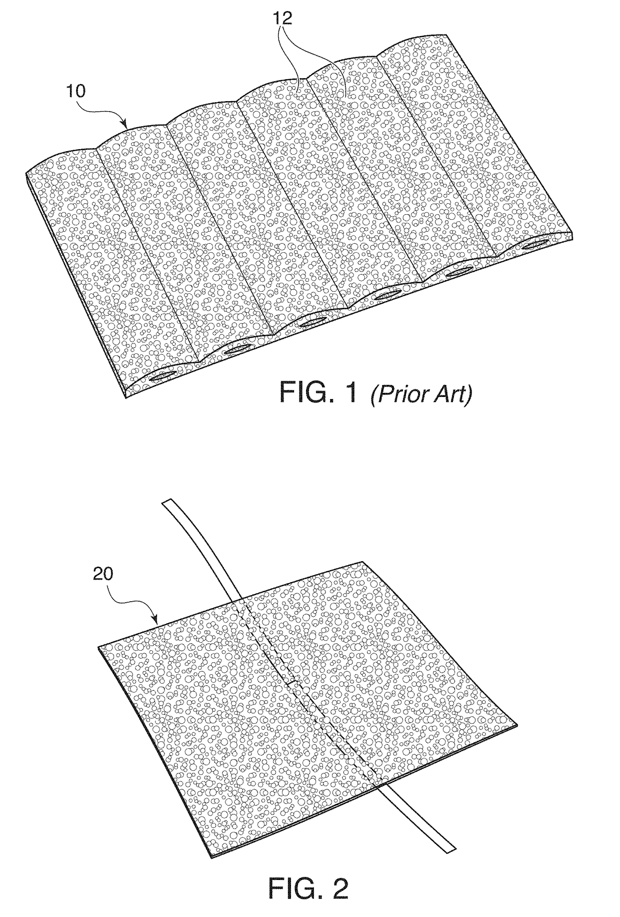 Channel Implant