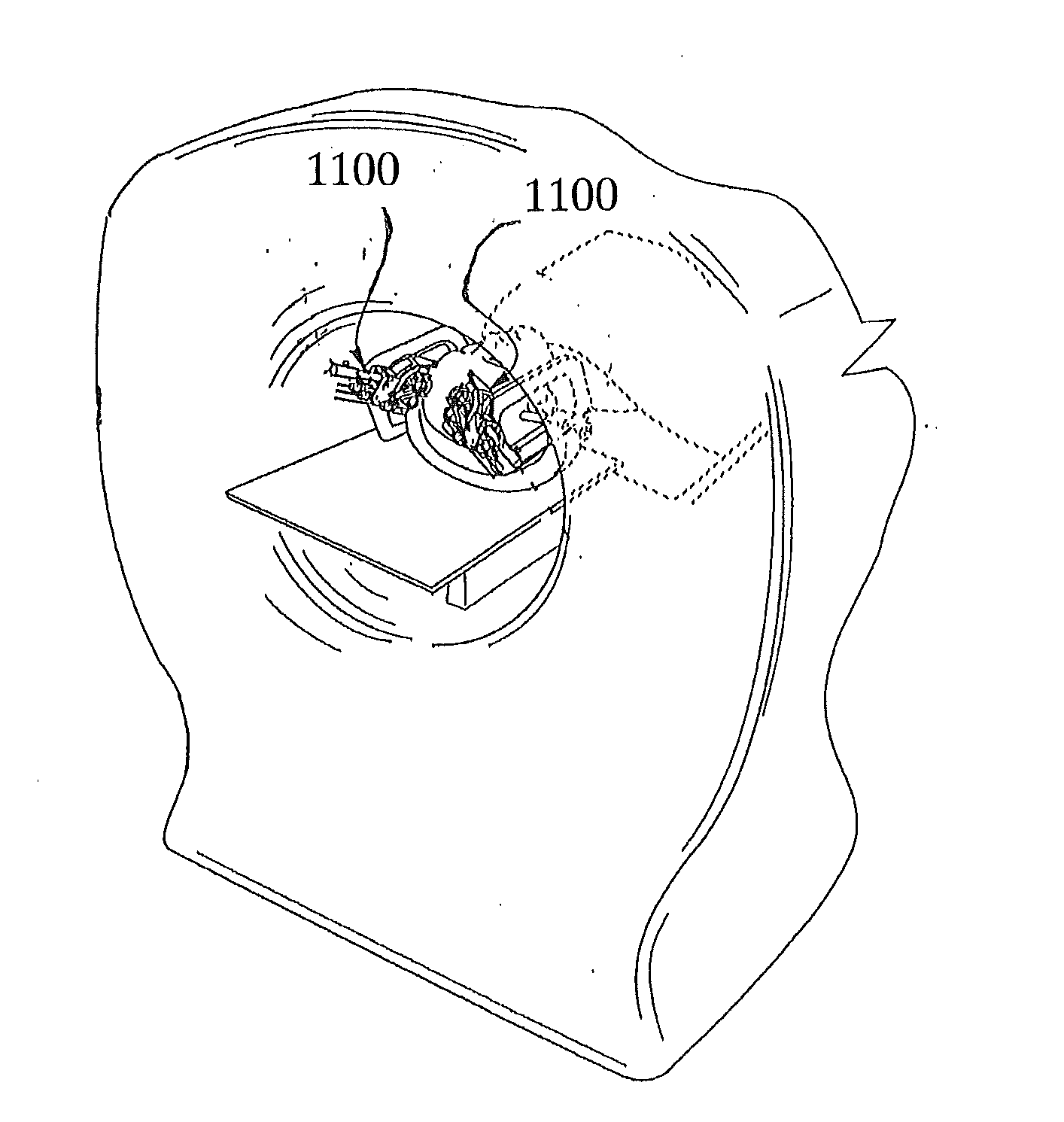 MRI-Guided Medical Interventional Systems and Methods