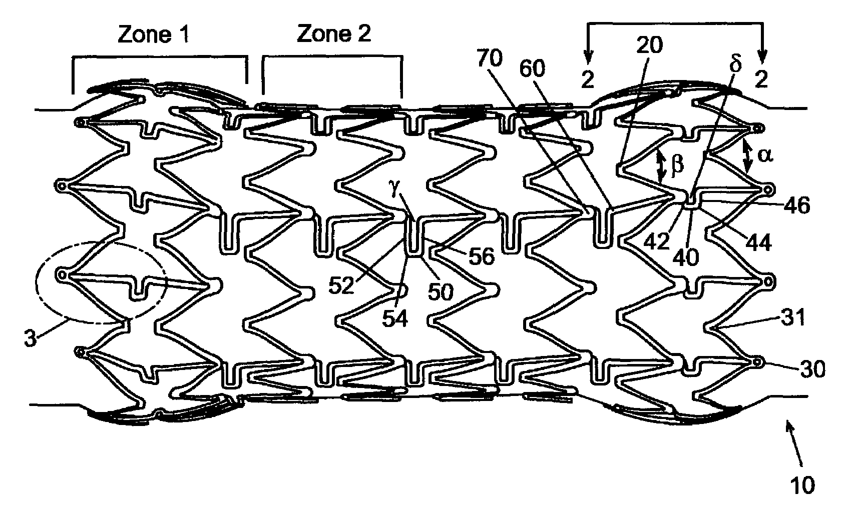 Stent with geometry determinated functionality and method of making the same