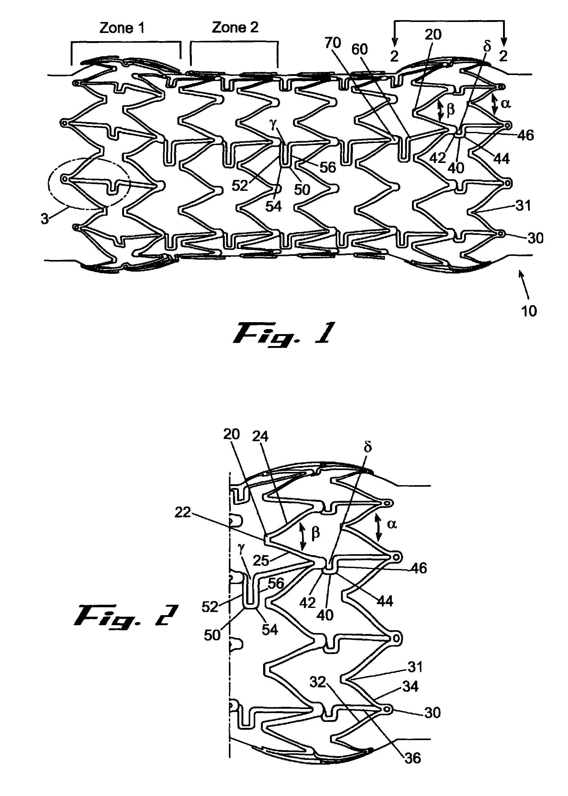 Stent with geometry determinated functionality and method of making the same