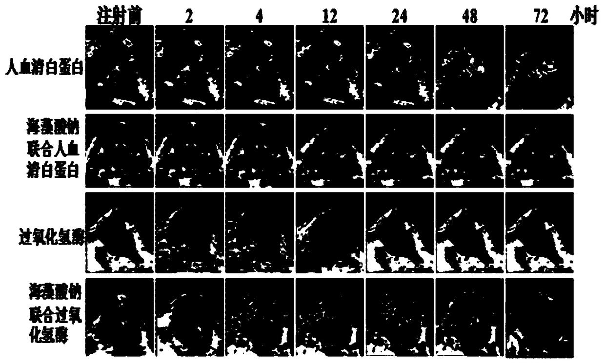 A composition comprising catalase and its application