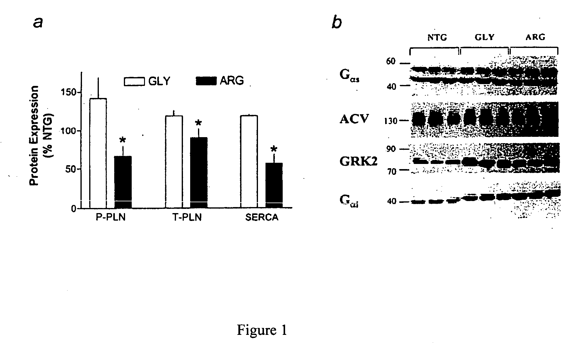 Methods for diagnosis, prediction and treatment of heart failure and other cardiac conditions based on beta1-adrenergic receptor polymorphism