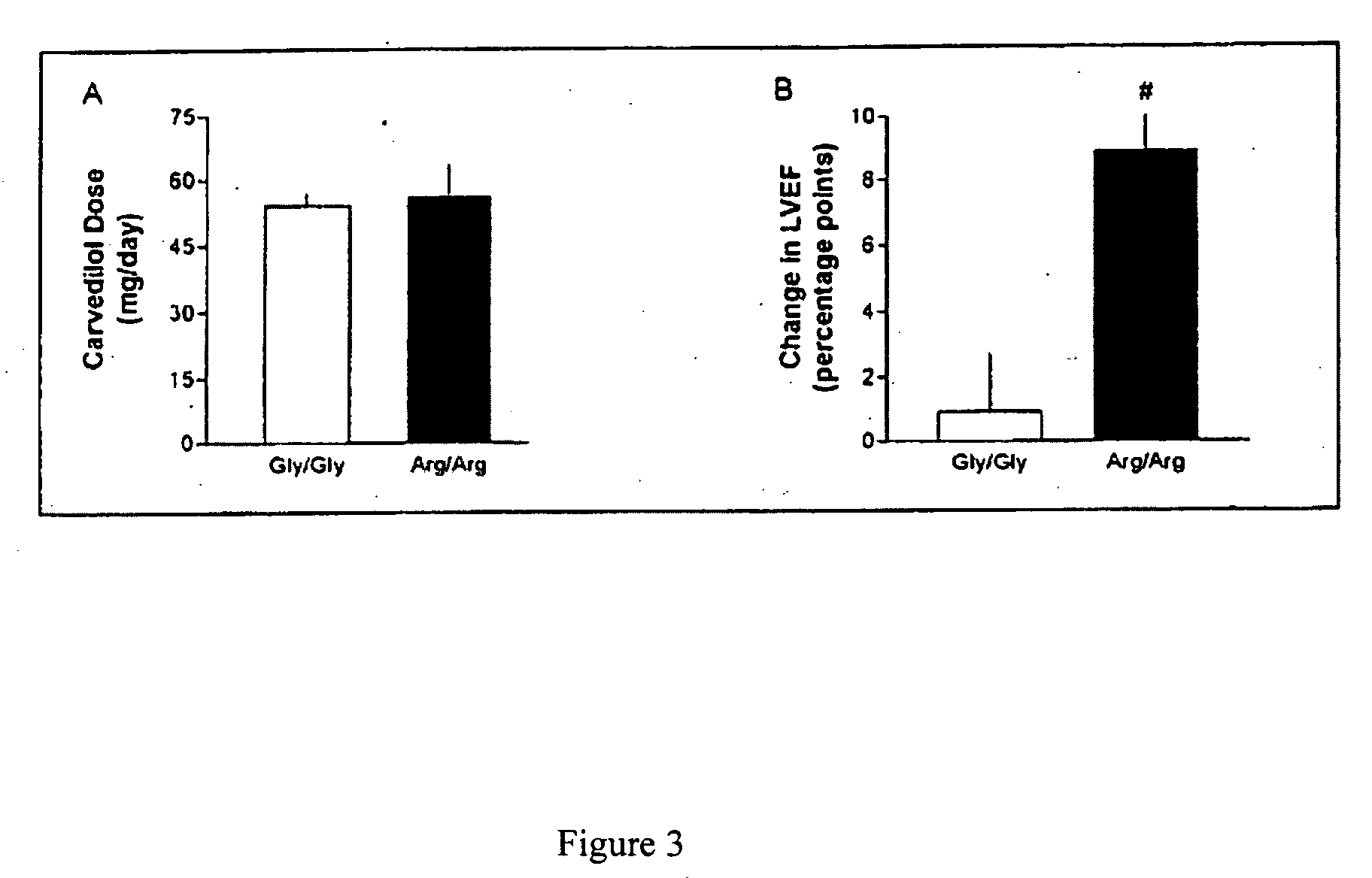 Methods for diagnosis, prediction and treatment of heart failure and other cardiac conditions based on beta1-adrenergic receptor polymorphism