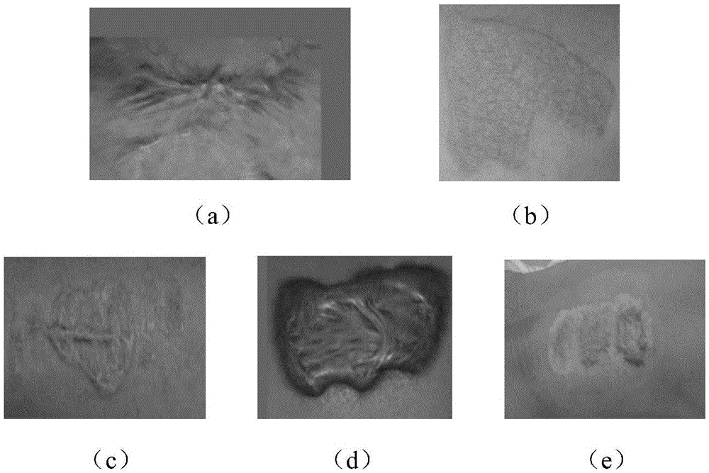 Image-processing-based evaluation method for scar treatment effect