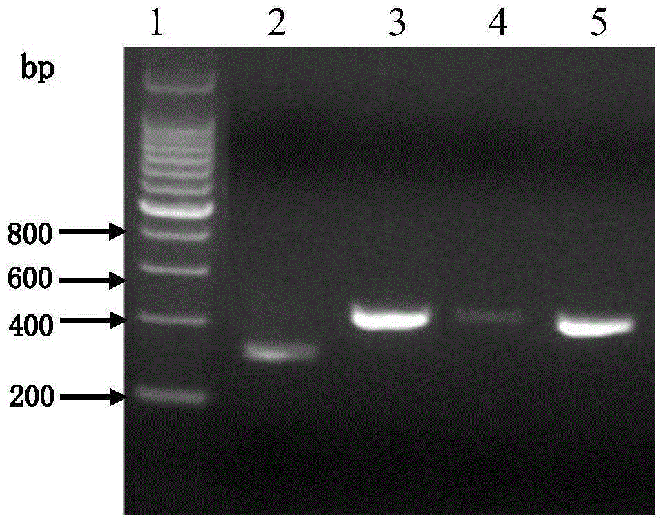 Anti-human tissue kallikrein 1 antibody and application thereof