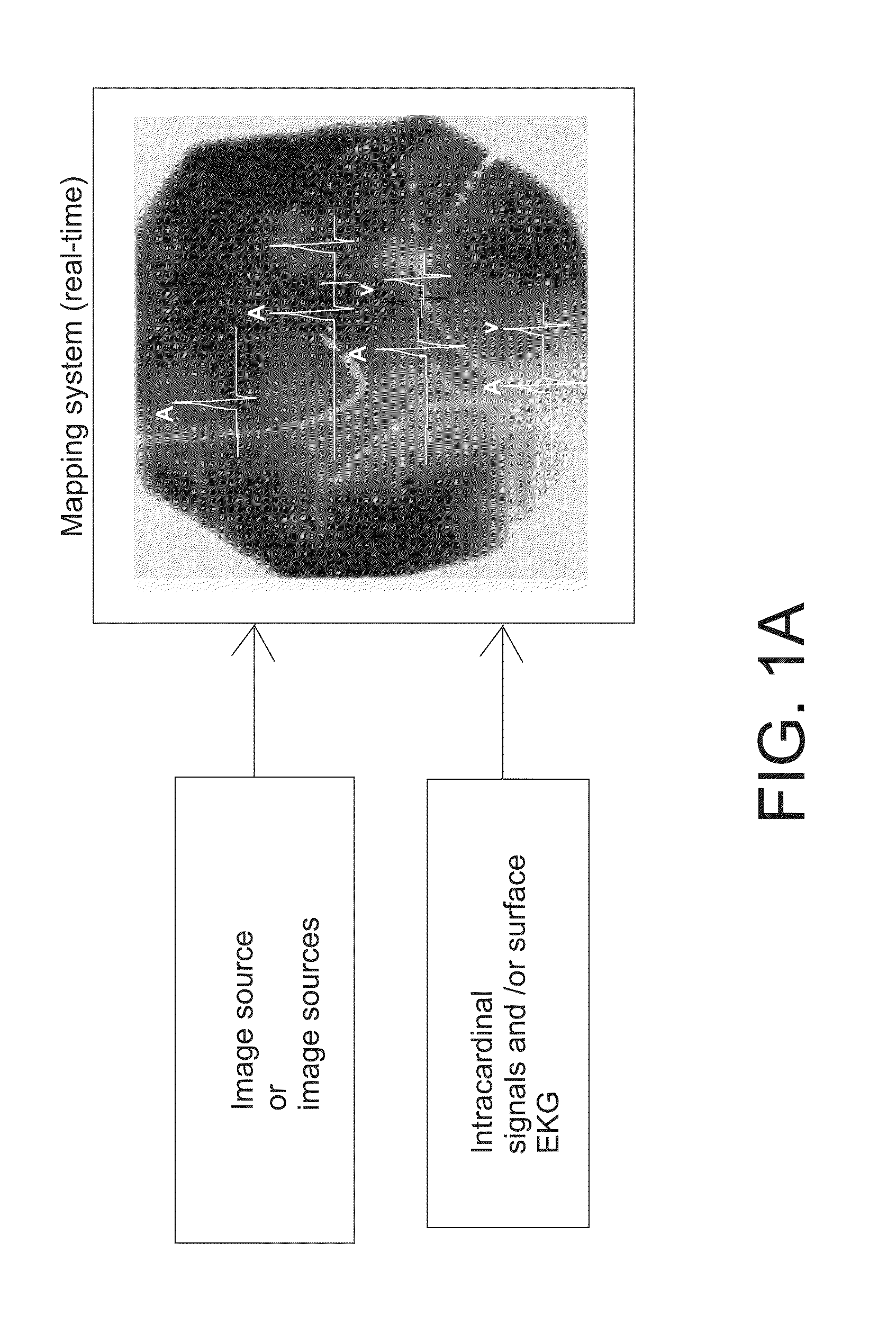 Methods and system for real-time cardiac mapping