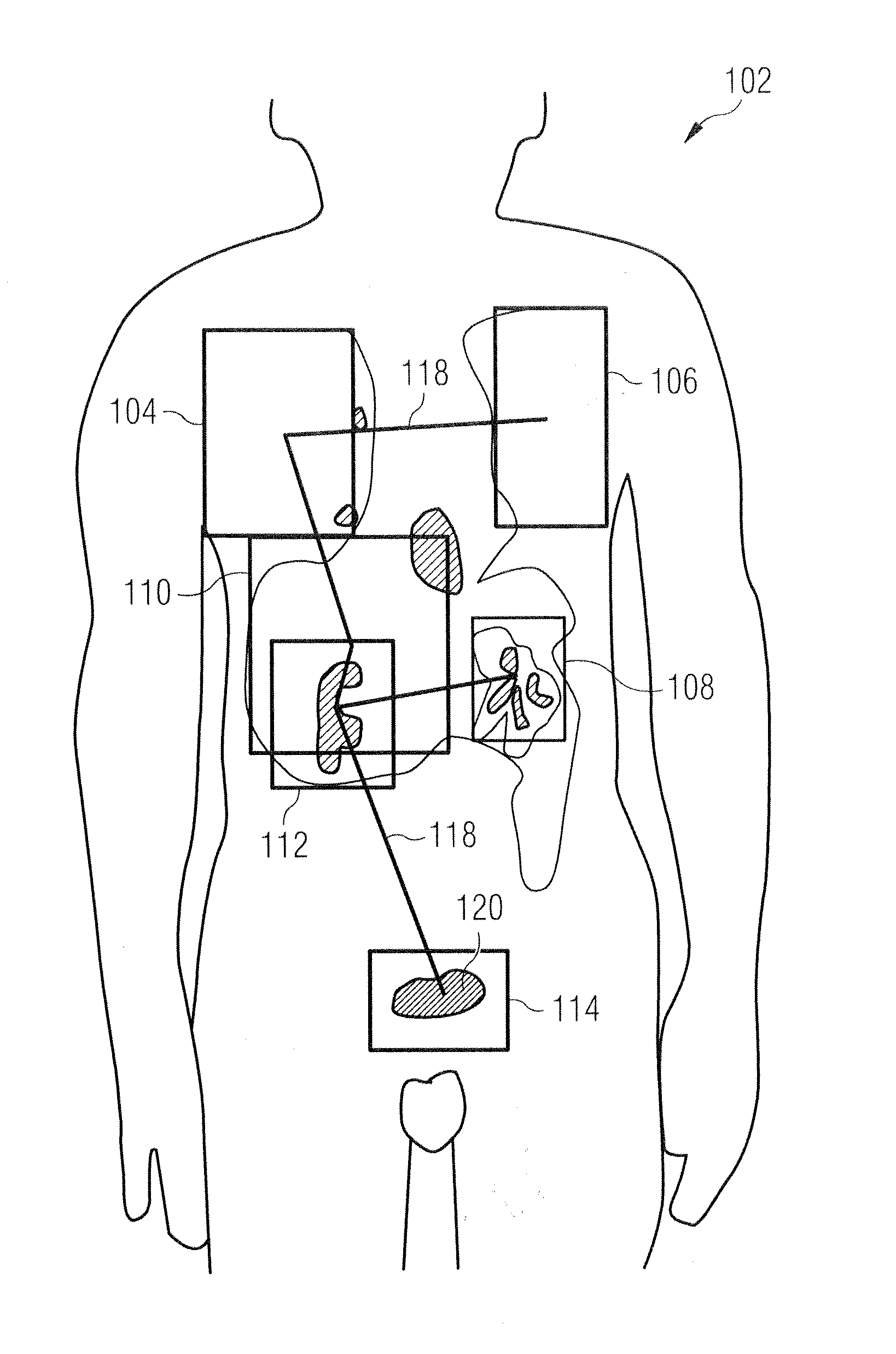 Methods and apparatus for registration of medical images